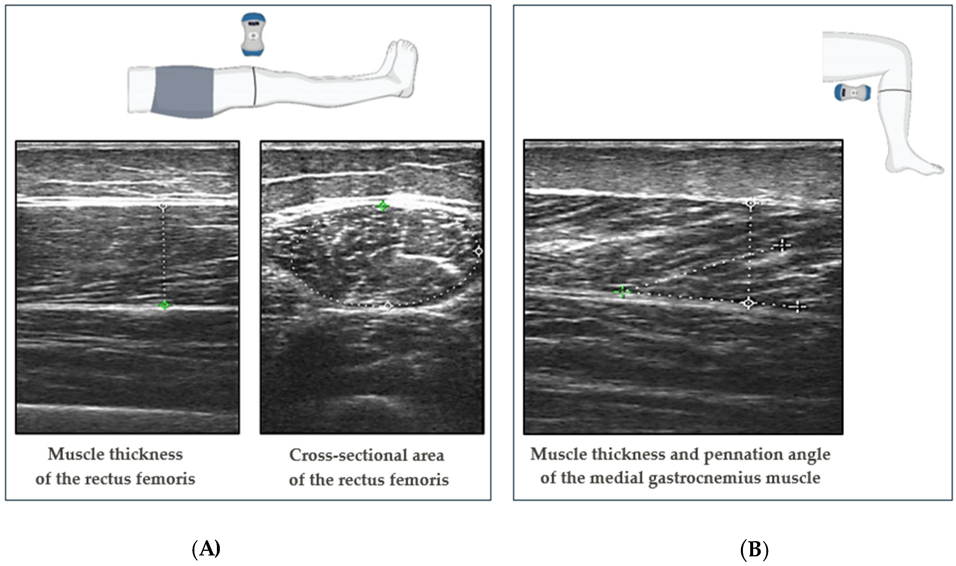 Diagnostics 14 01582 g001