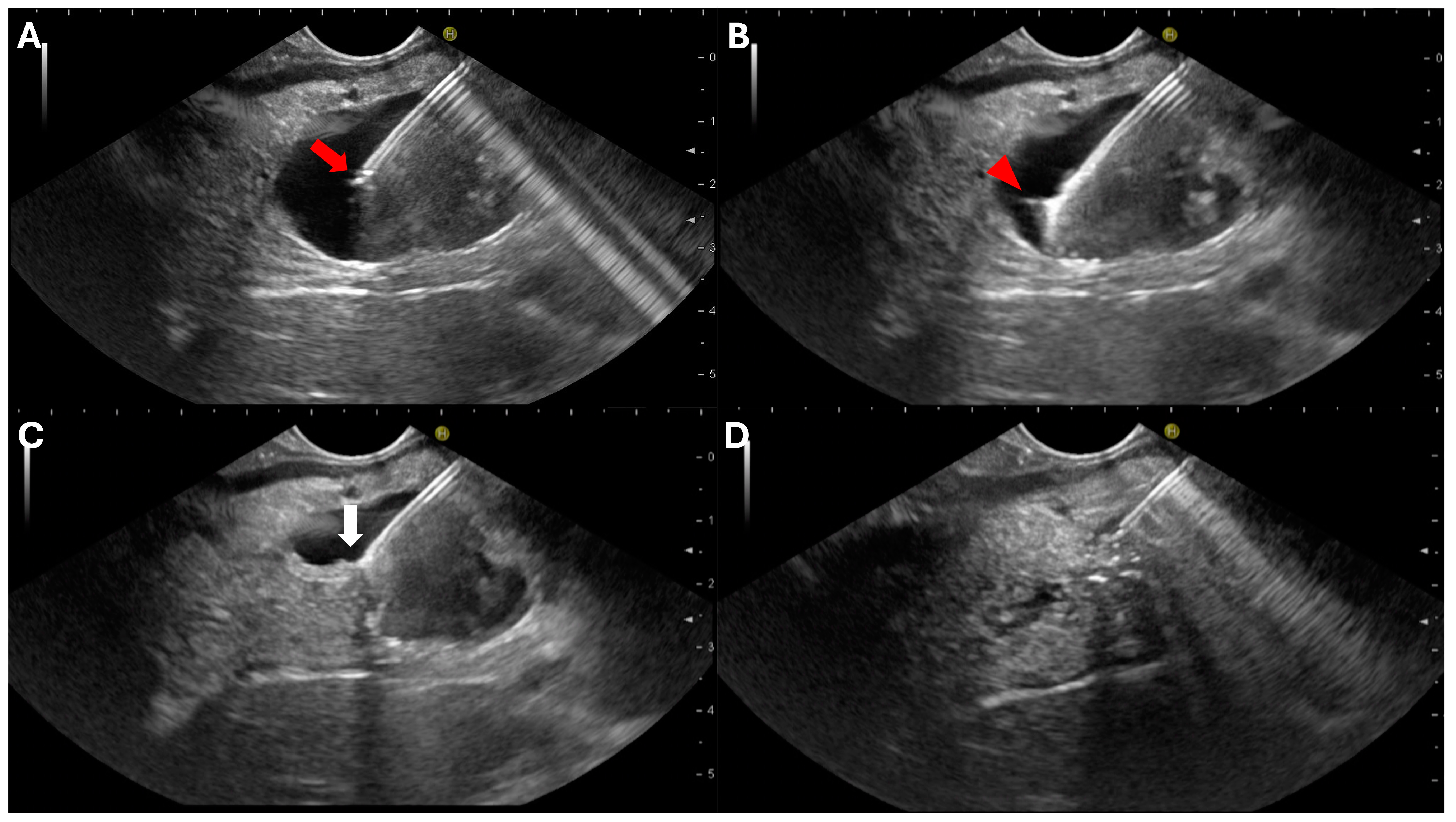 Diagnostics 14 01587 g002 Diagnostics 14 01587 g002