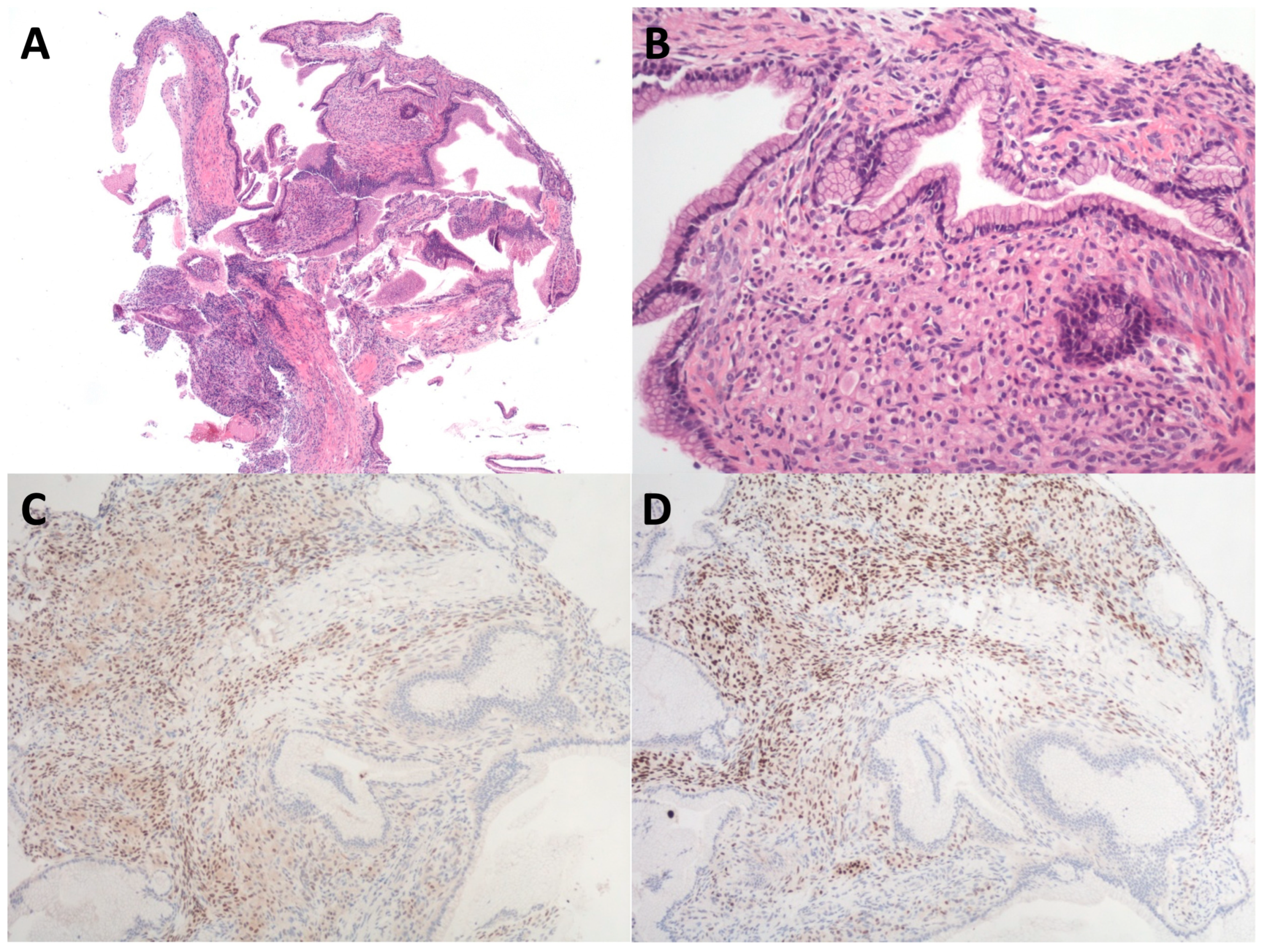 Diagnostics 14 01587 g005 Diagnostics 14 01587 g005