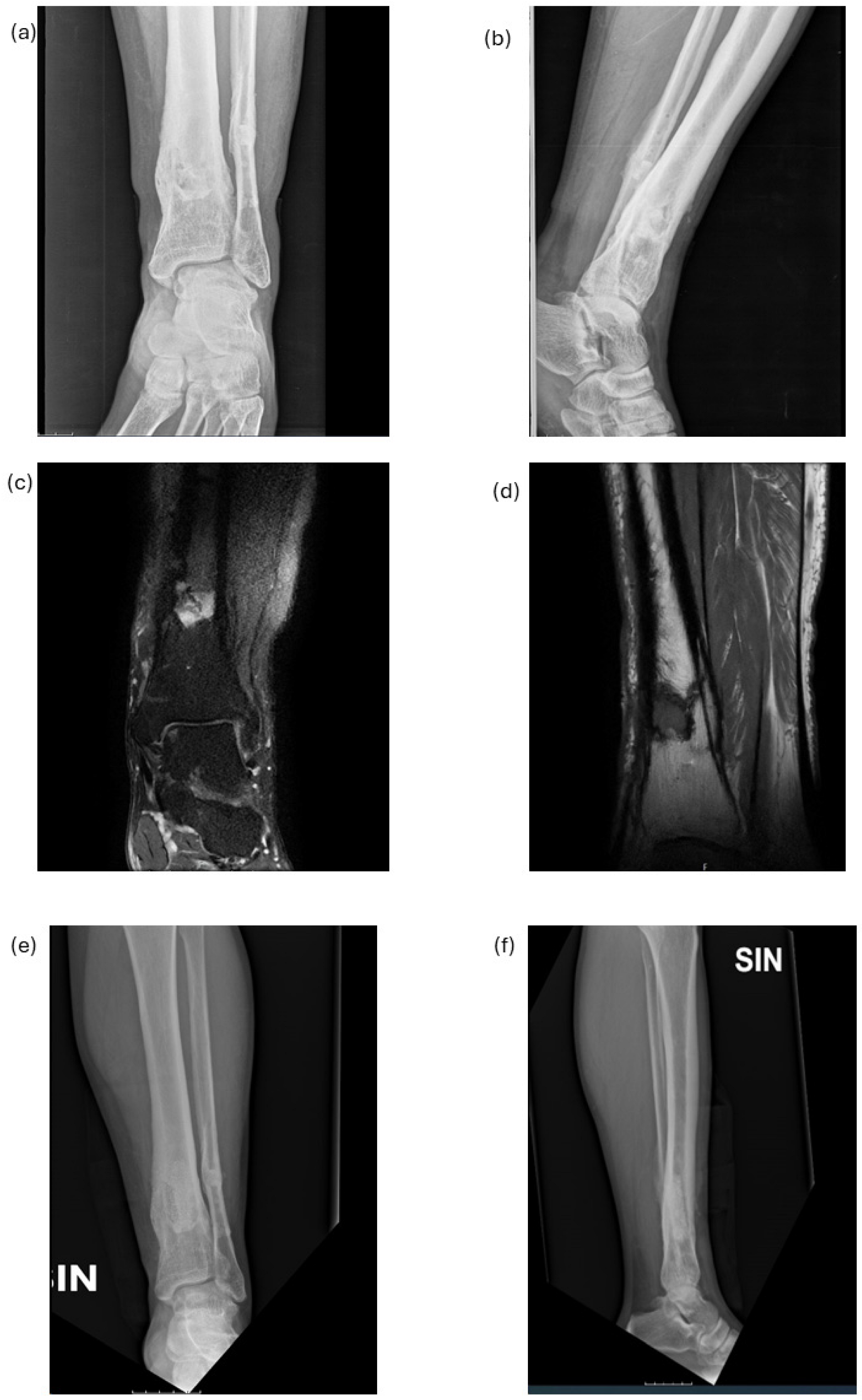 Diagnostics 14 01588 g005