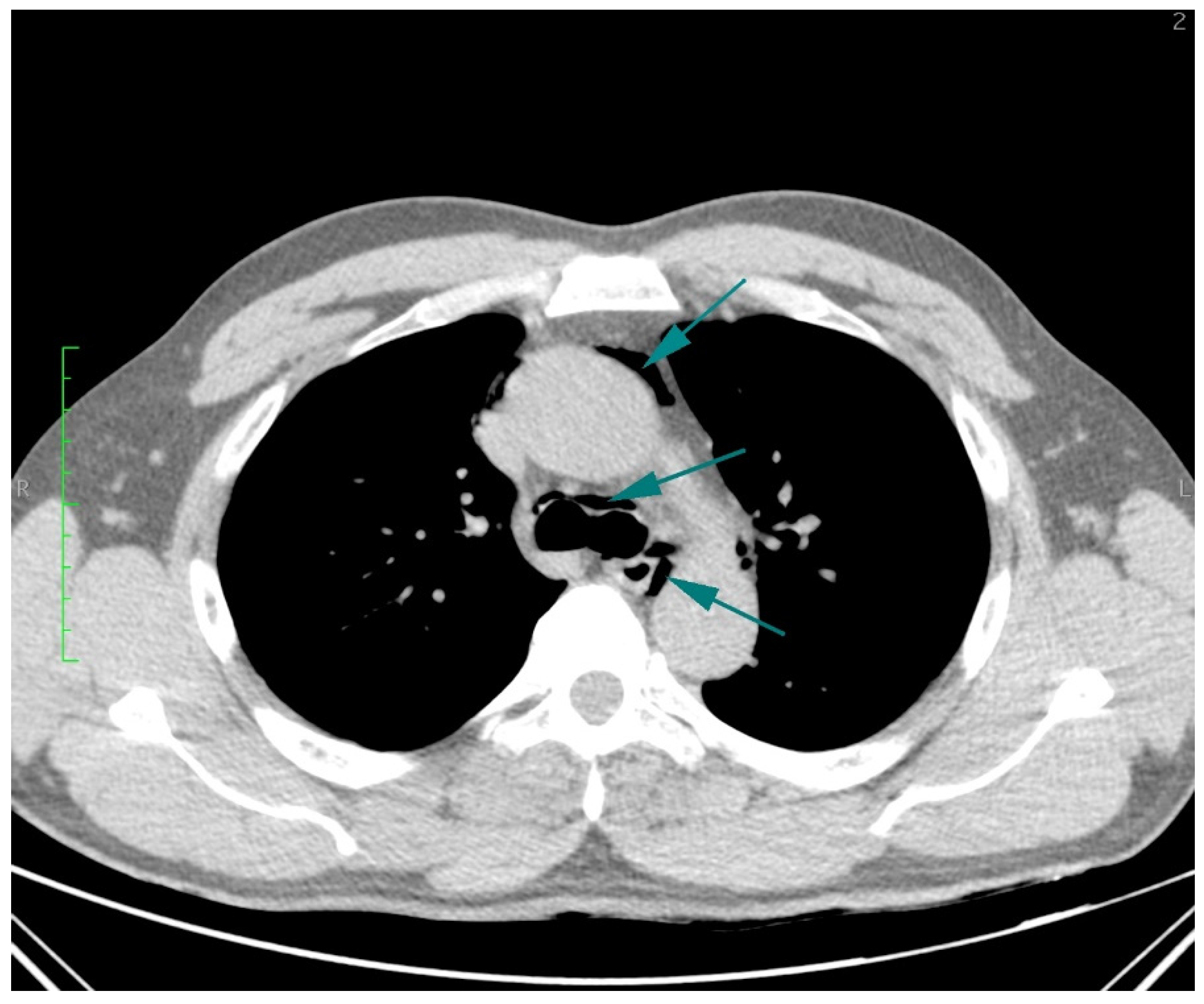 Diagnostics 14 01592 g001