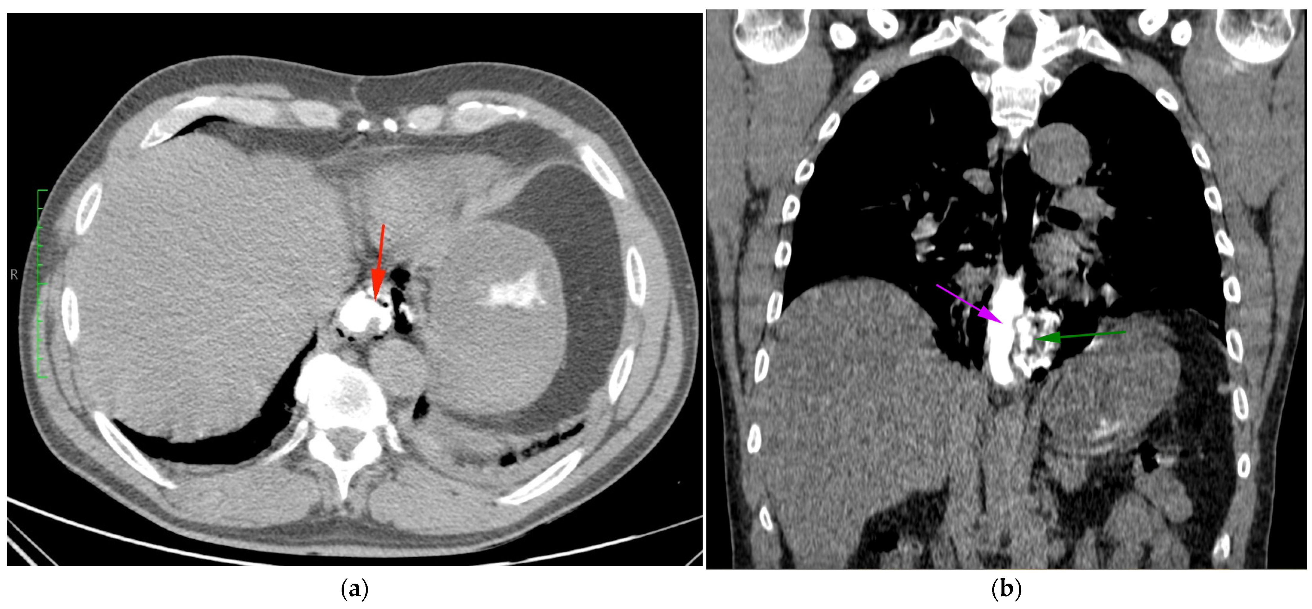 Diagnostics 14 01592 g002