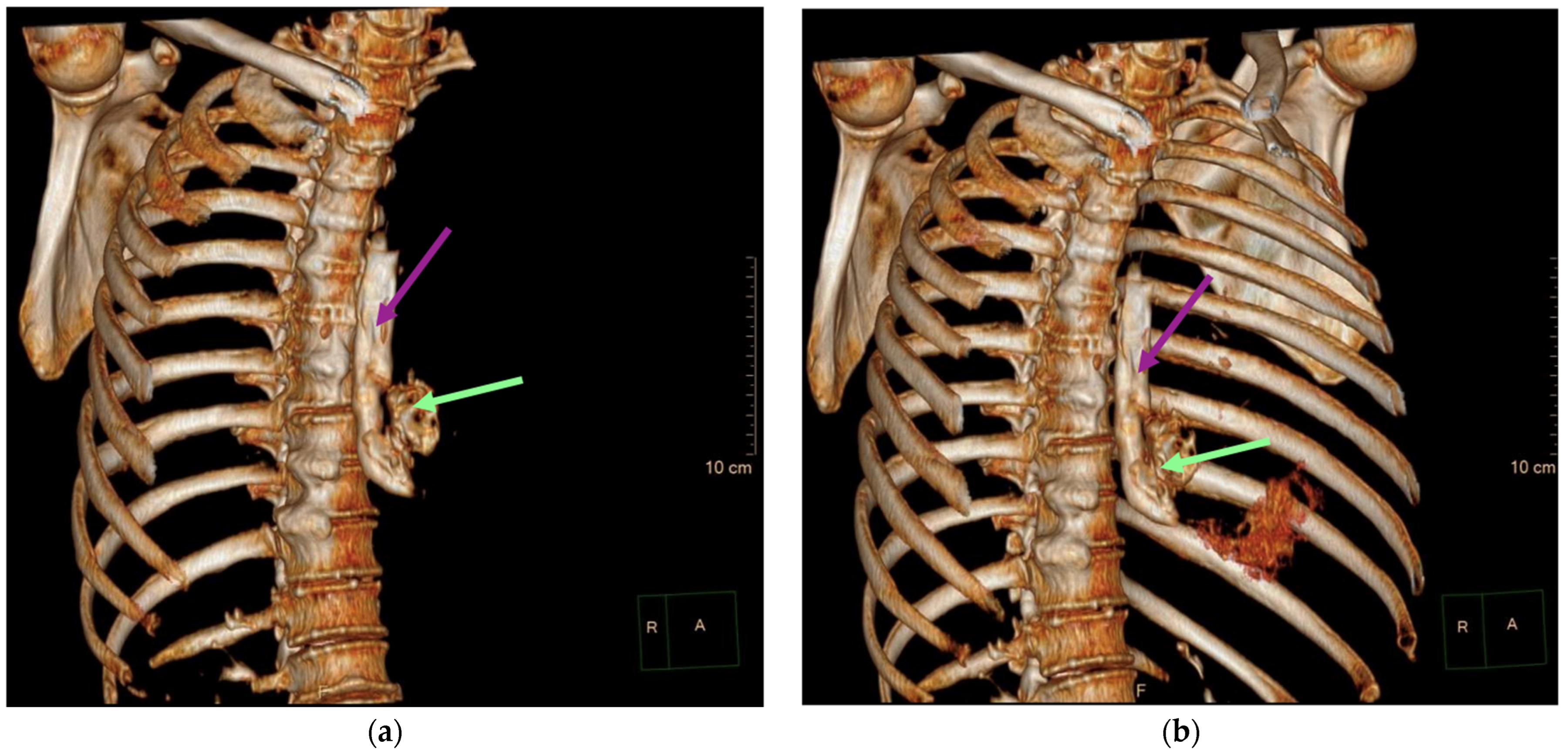 Diagnostics 14 01592 g003
