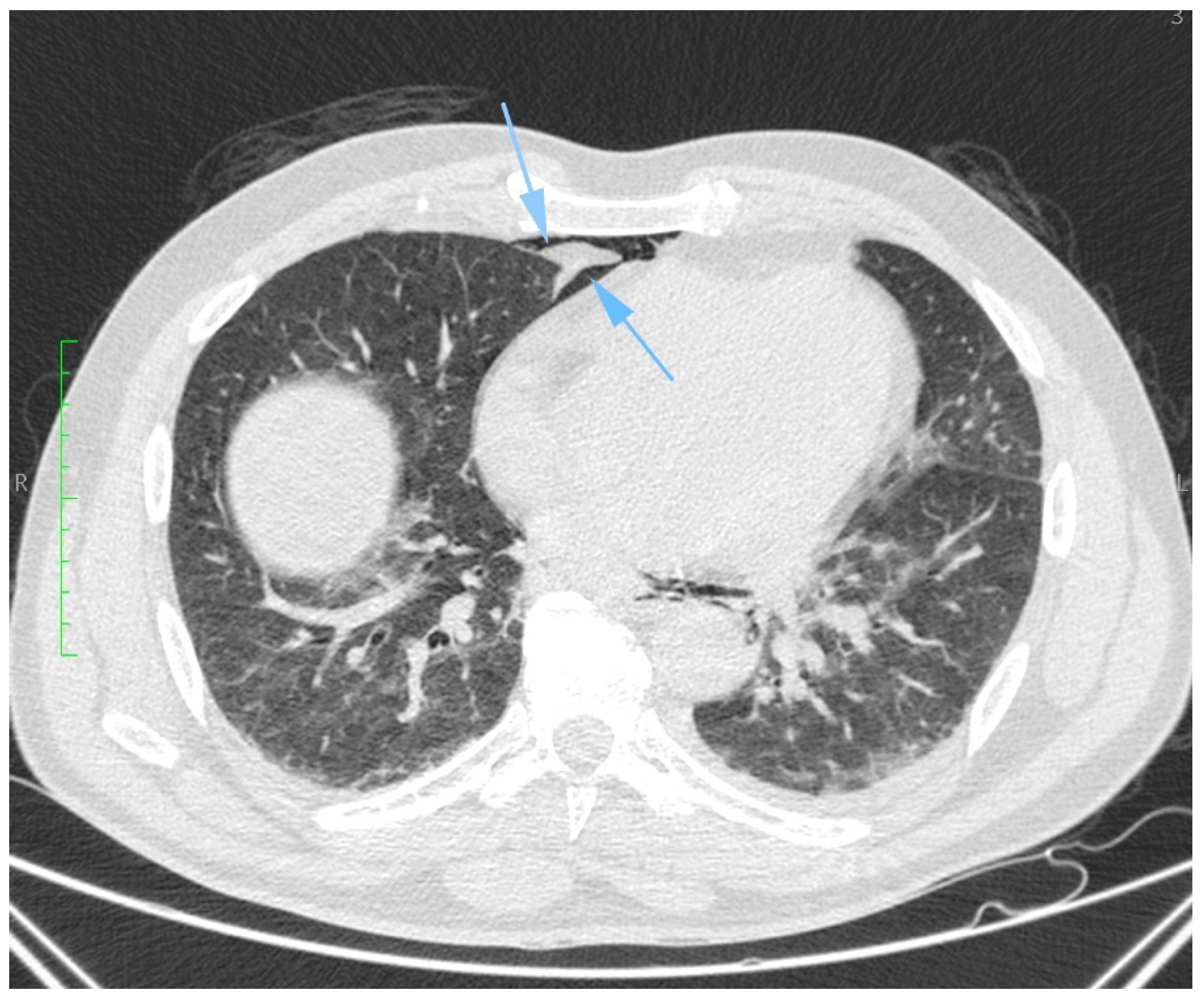 Diagnostics 14 01592 g004