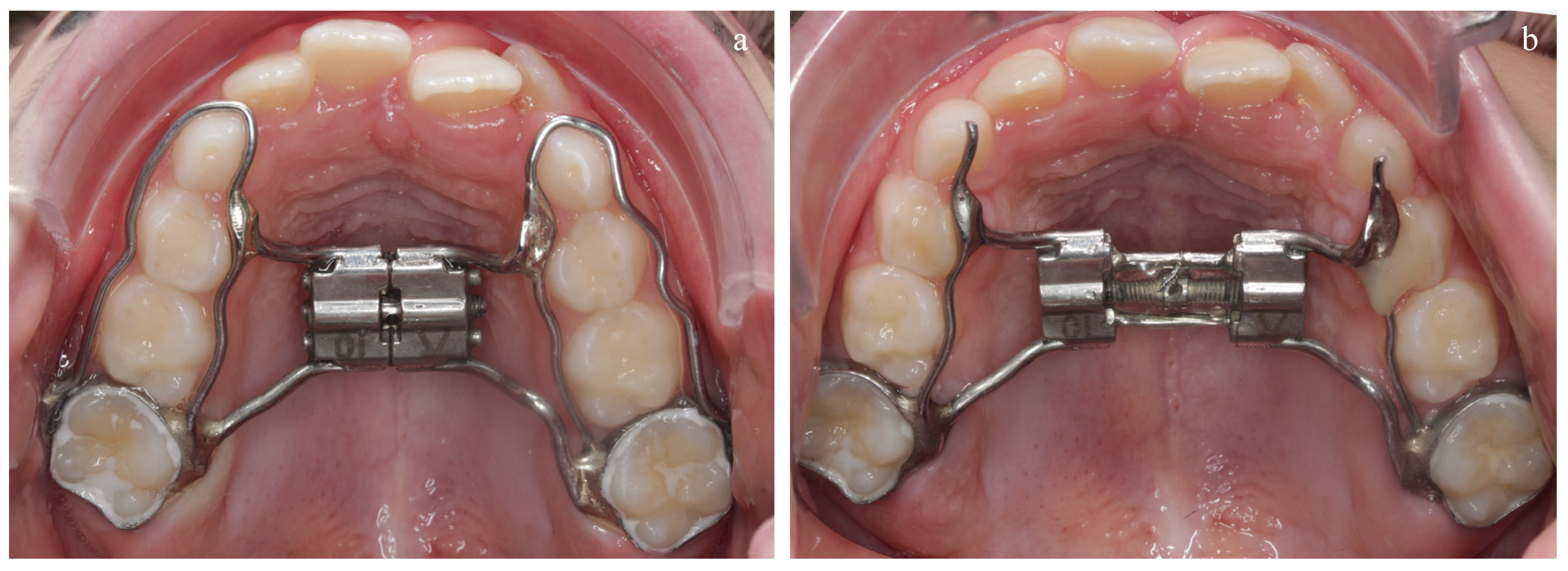 Diagnostics 14 01593 g004