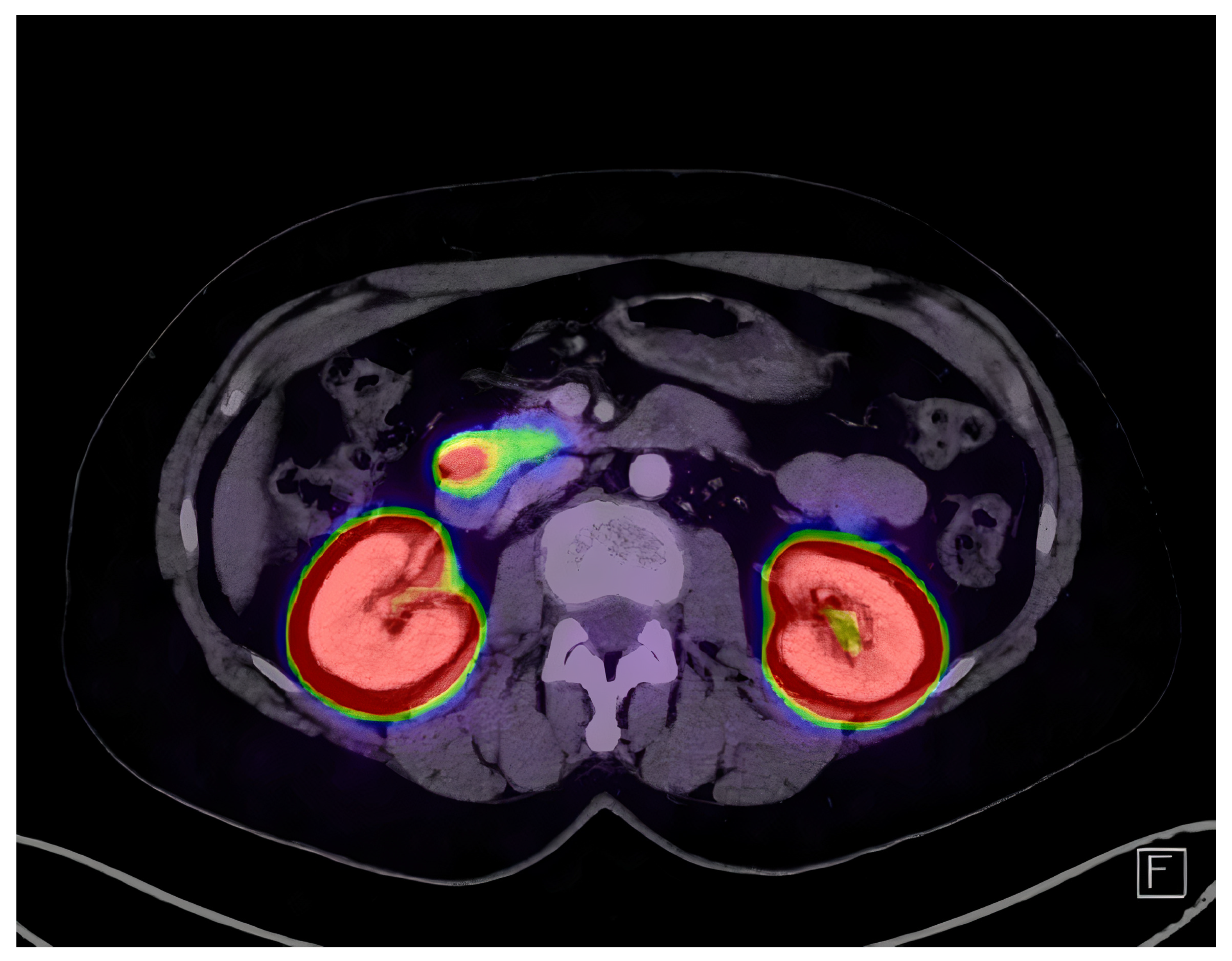 Diagnostics 14 01600 g001