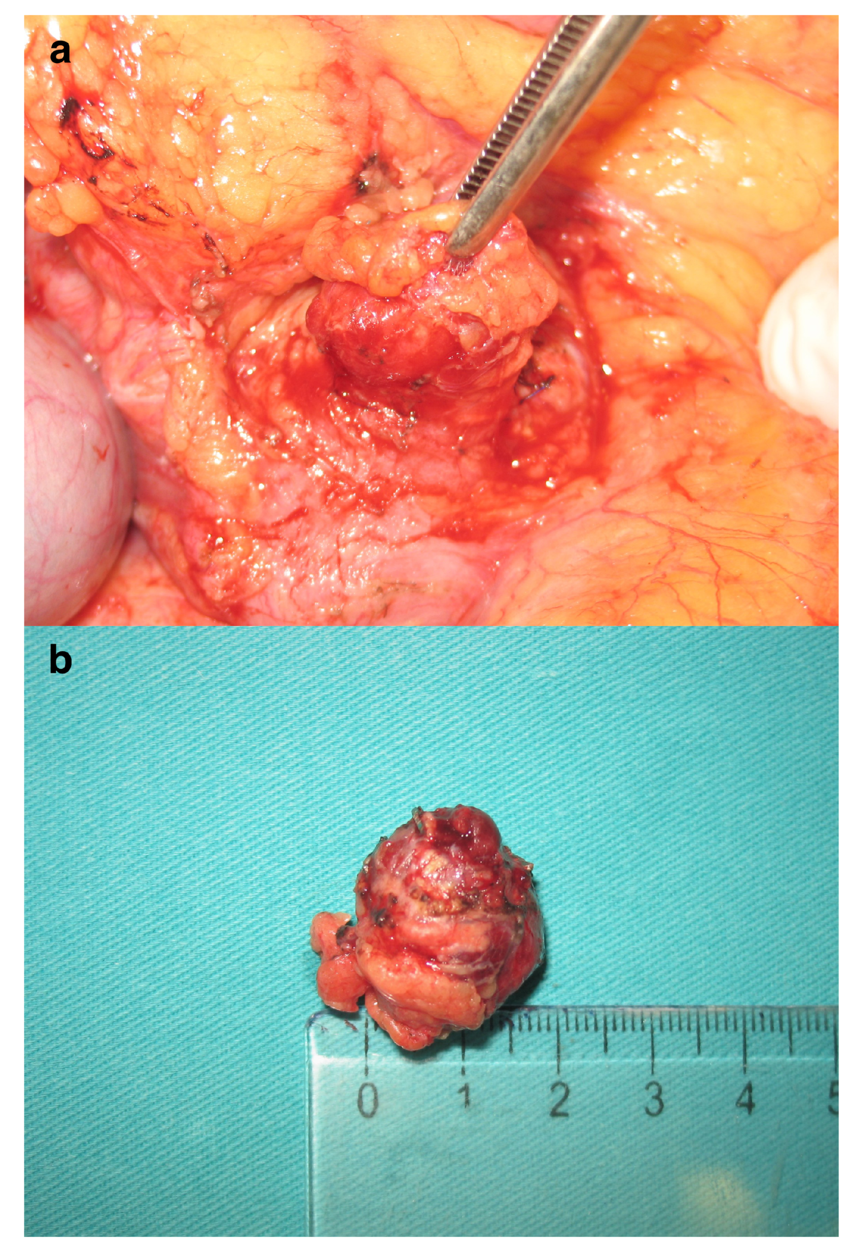 Diagnostics 14 01600 g002
