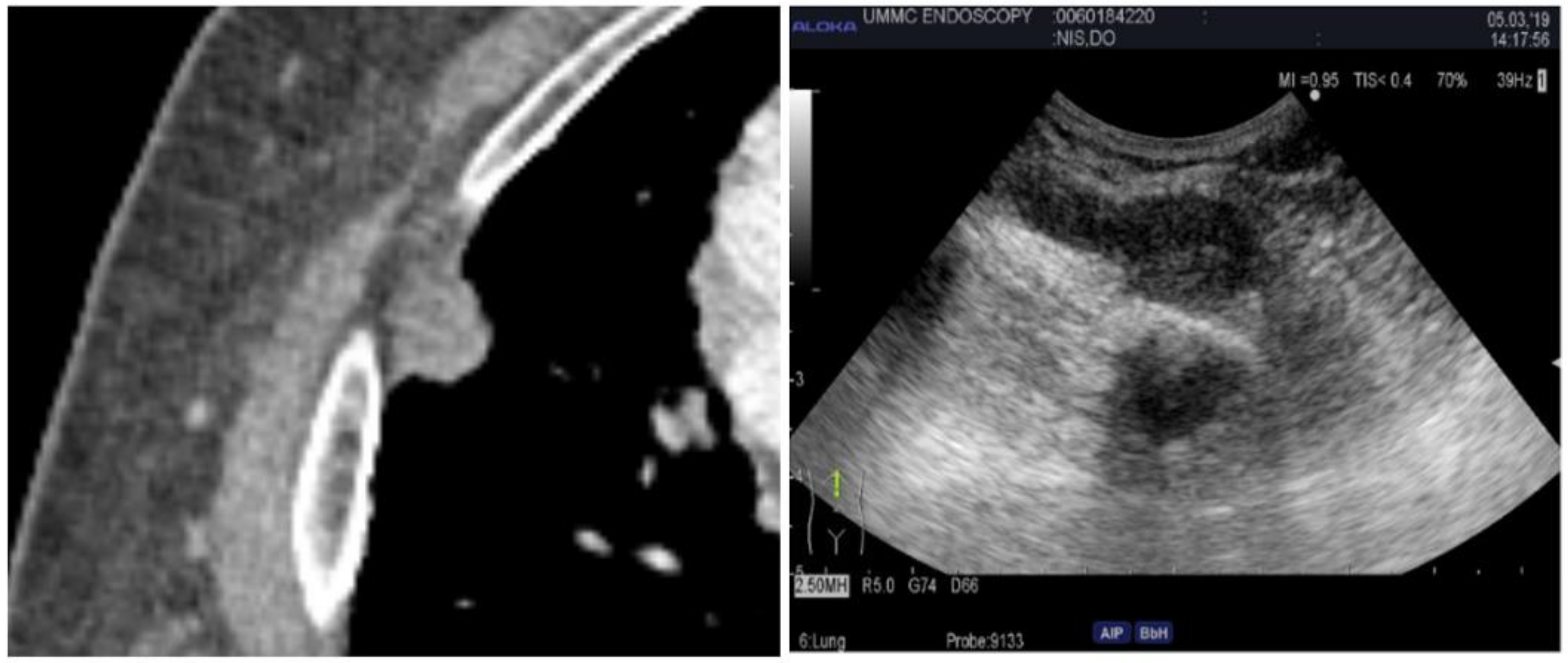 Diagnostics 14 01604 g005 Diagnostics 14 01604 g005