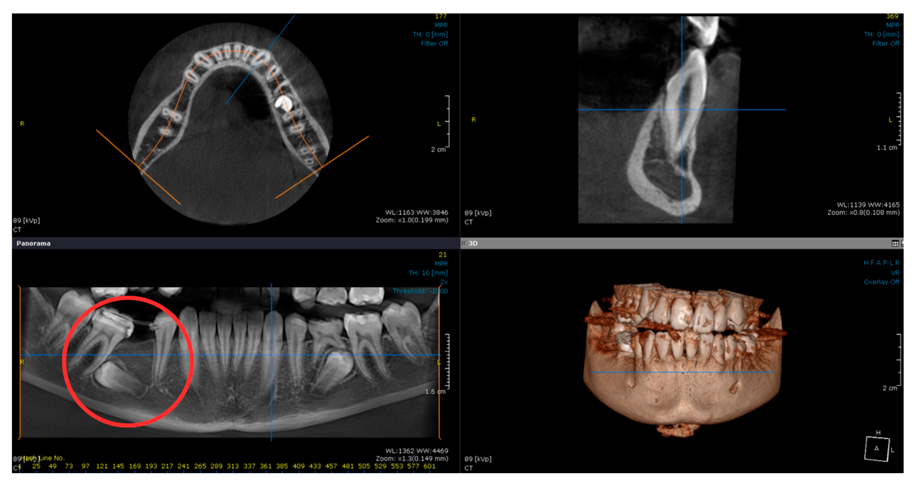 Diagnostics 14 01610 g004