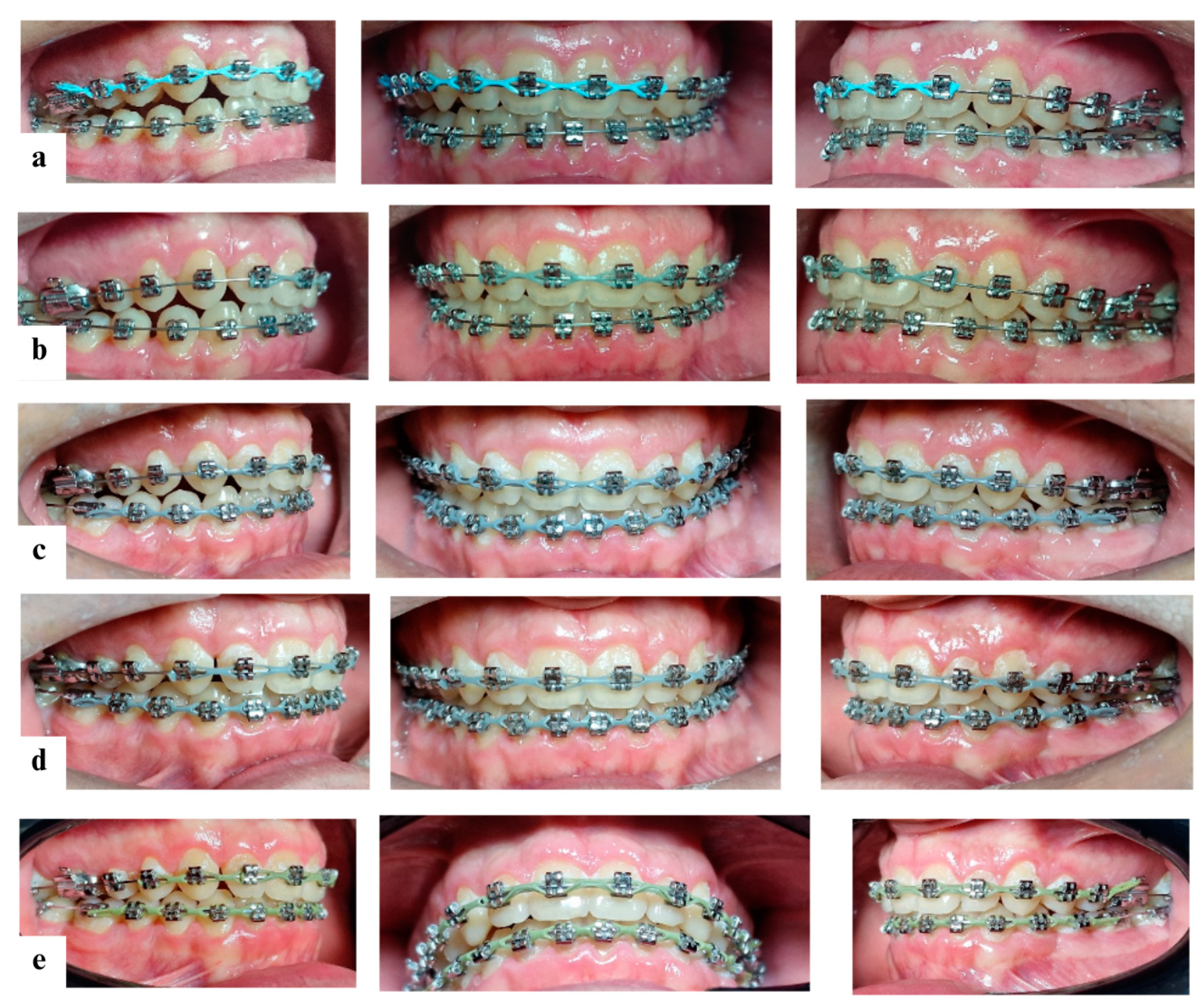 Diagnostics 14 01610 g007