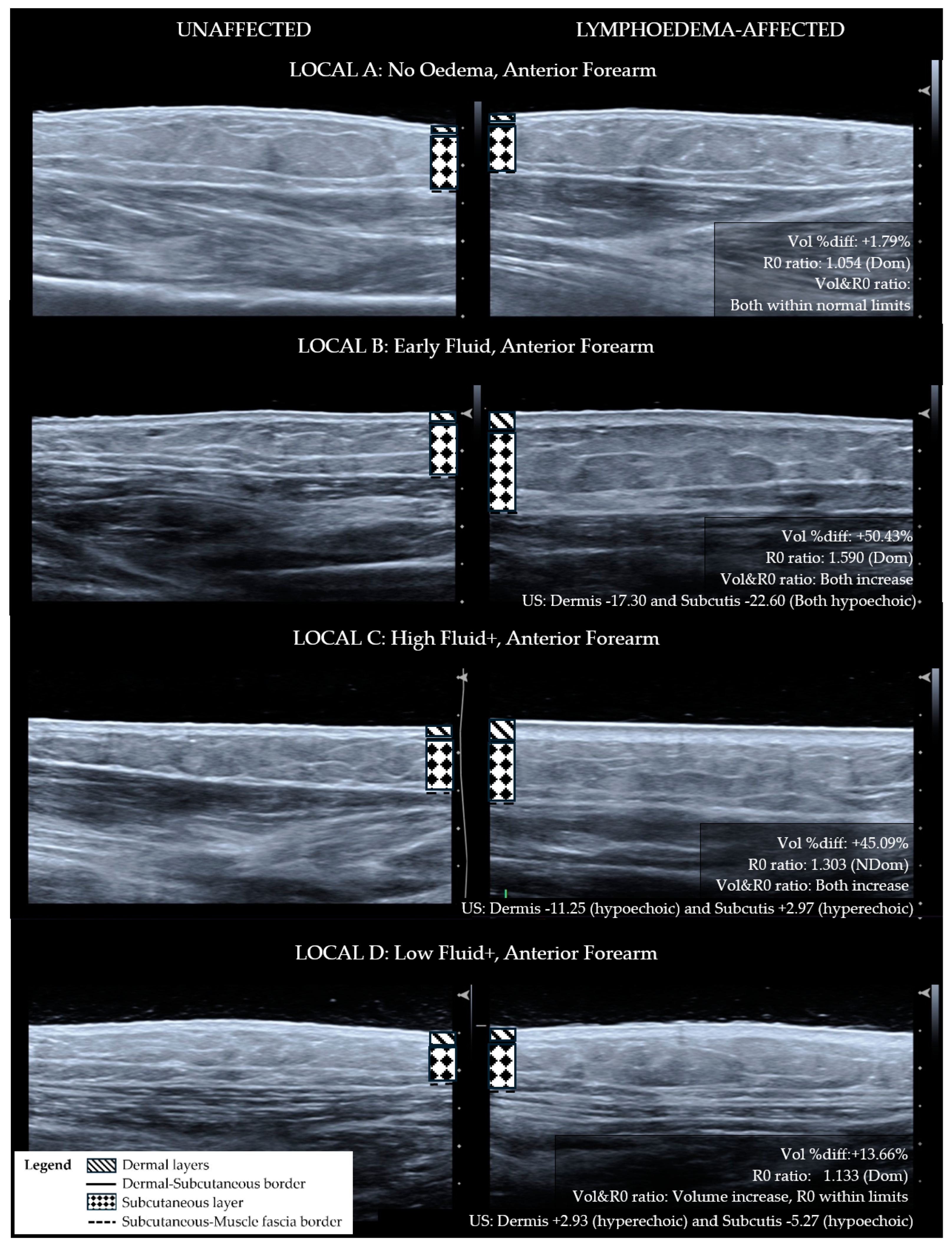 Diagnostics 14 01616 g001
