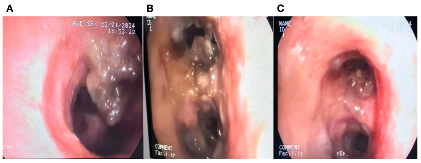 Diagnostics 14 01628 g001