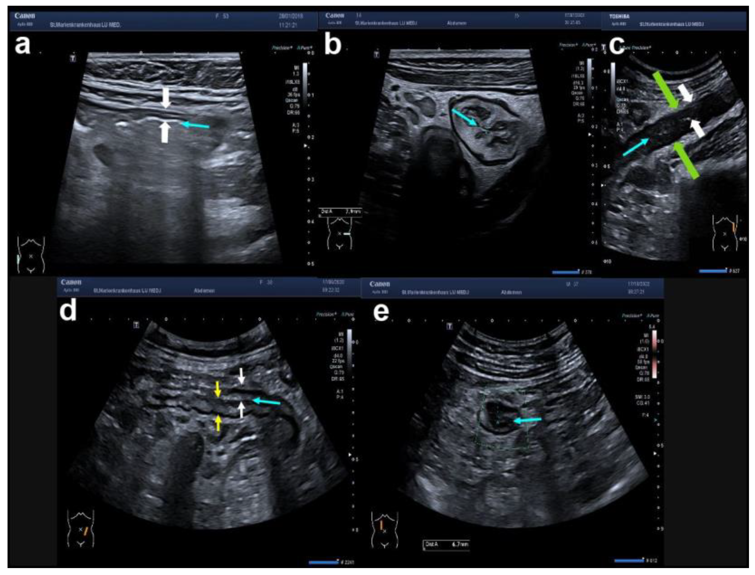 Diagnostics 14 01639 g002