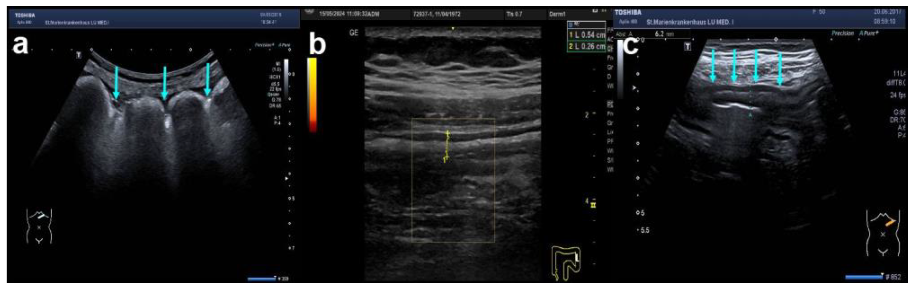 Diagnostics 14 01639 g004