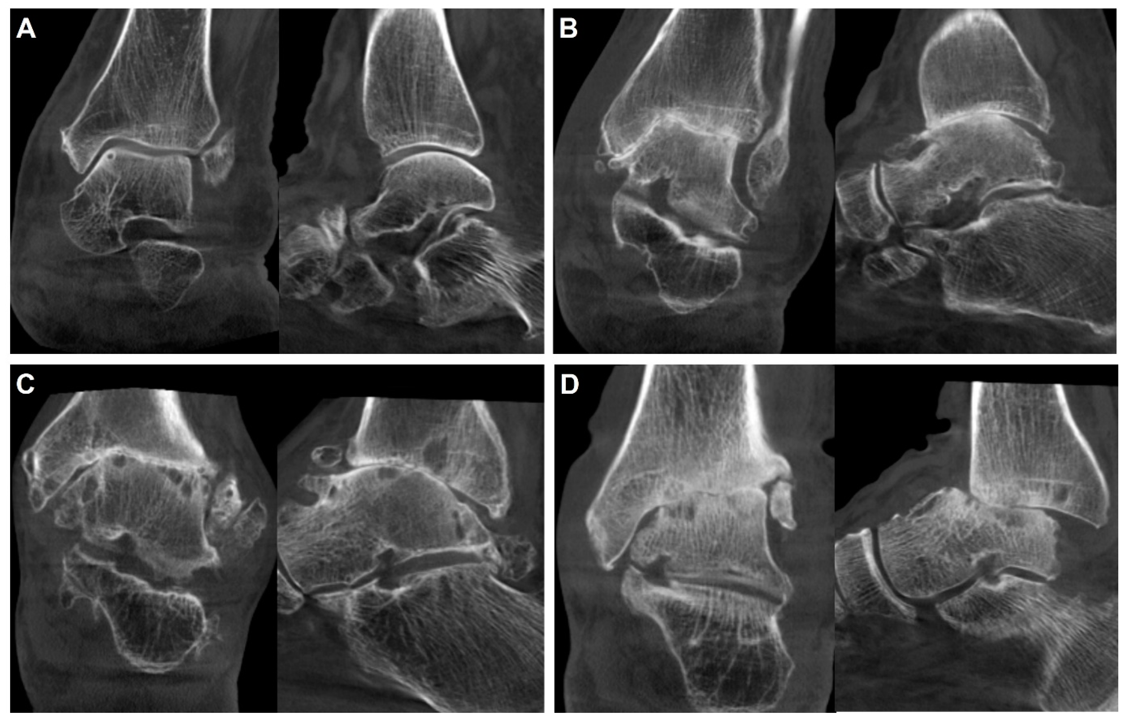 Diagnostics 14 01641 g004