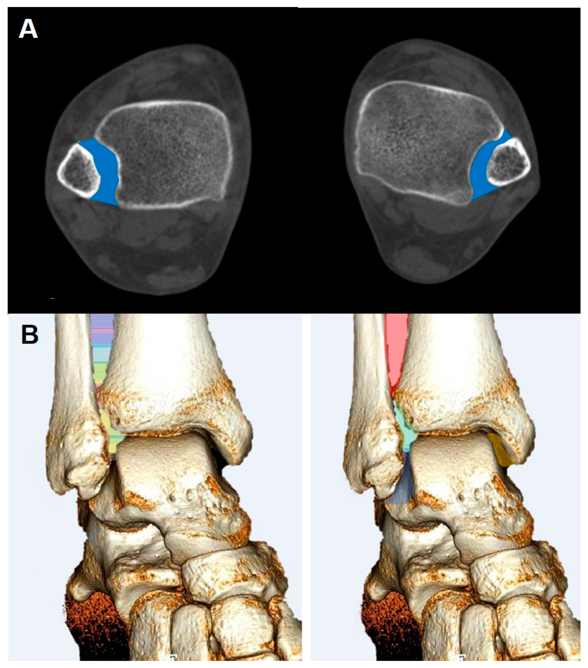 Diagnostics 14 01641 g007