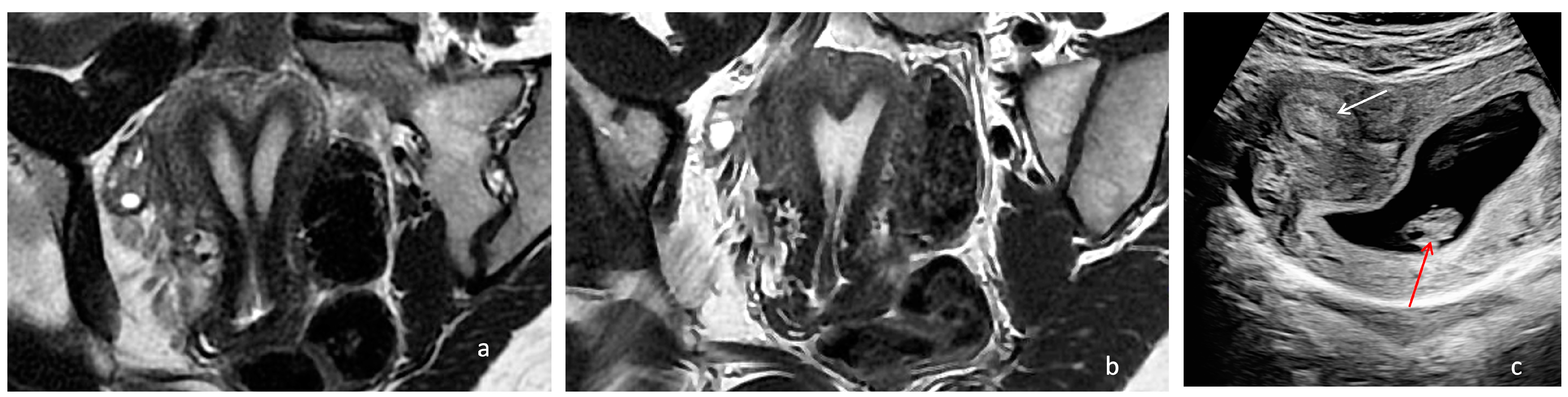 Diagnostics 14 01649 g004