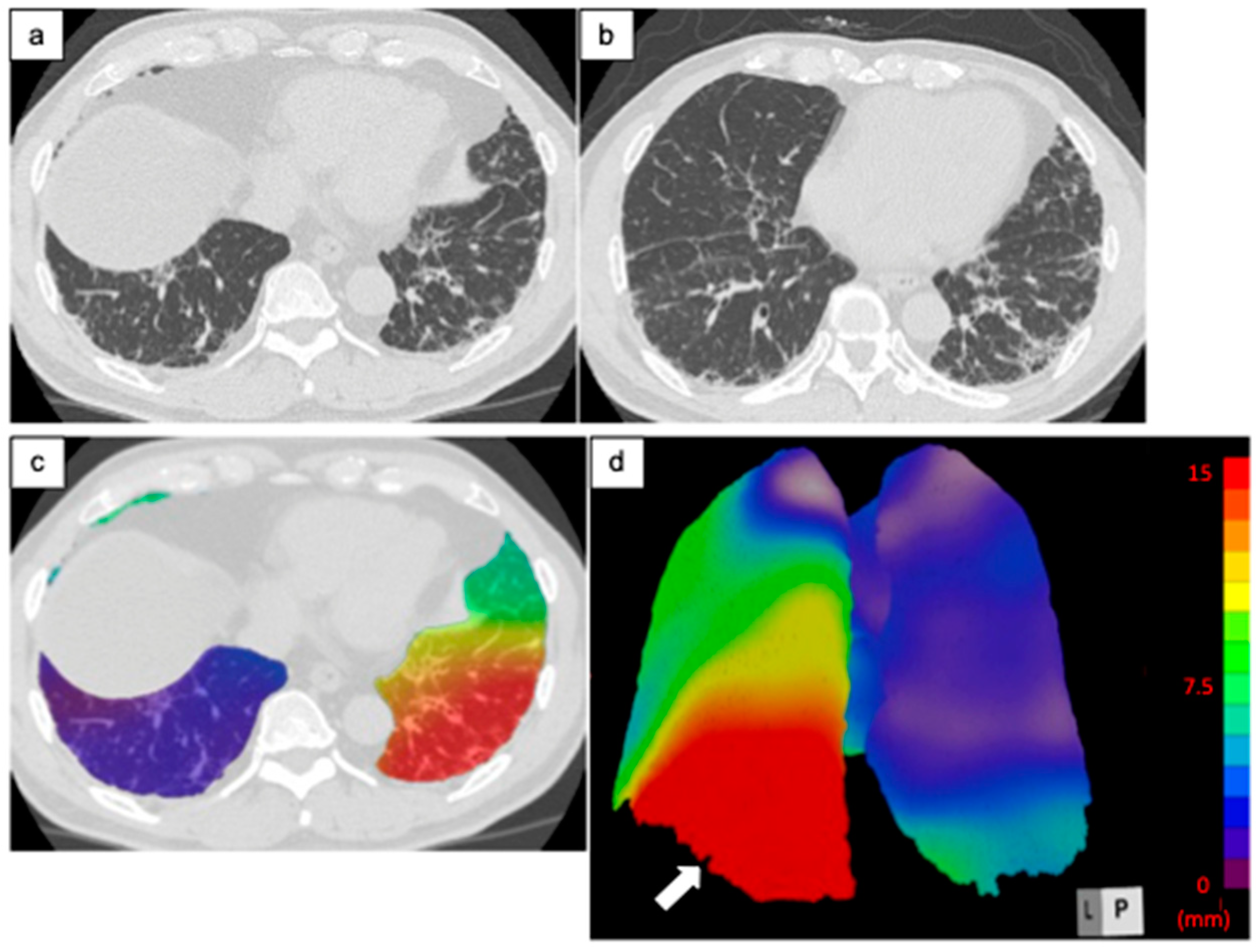 Diagnostics 14 01650 g004