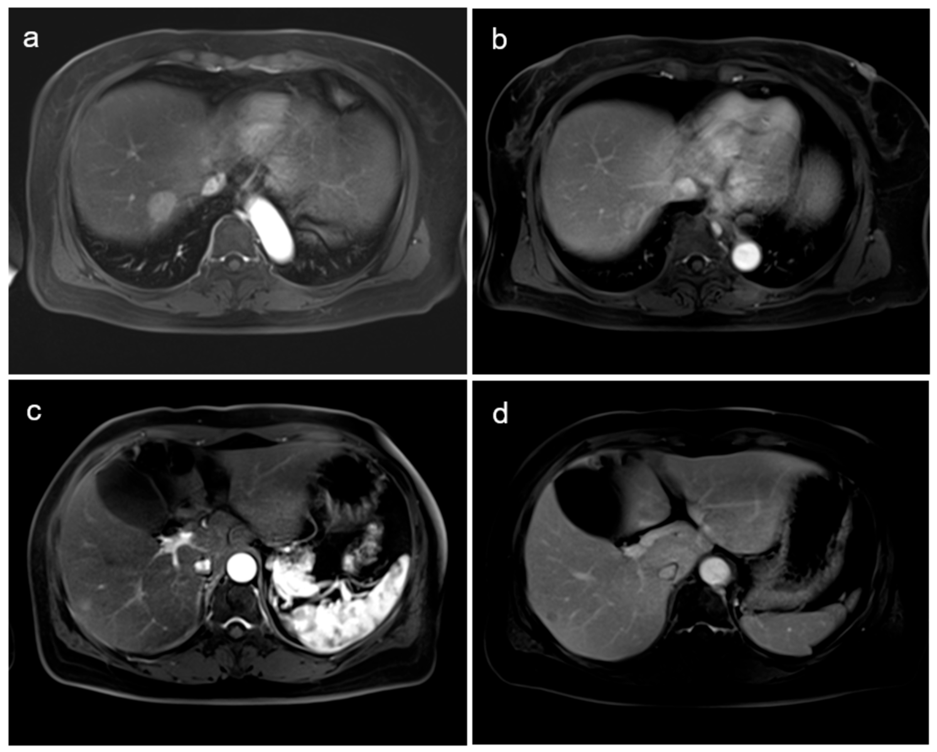 Diagnostics 14 01653 g003