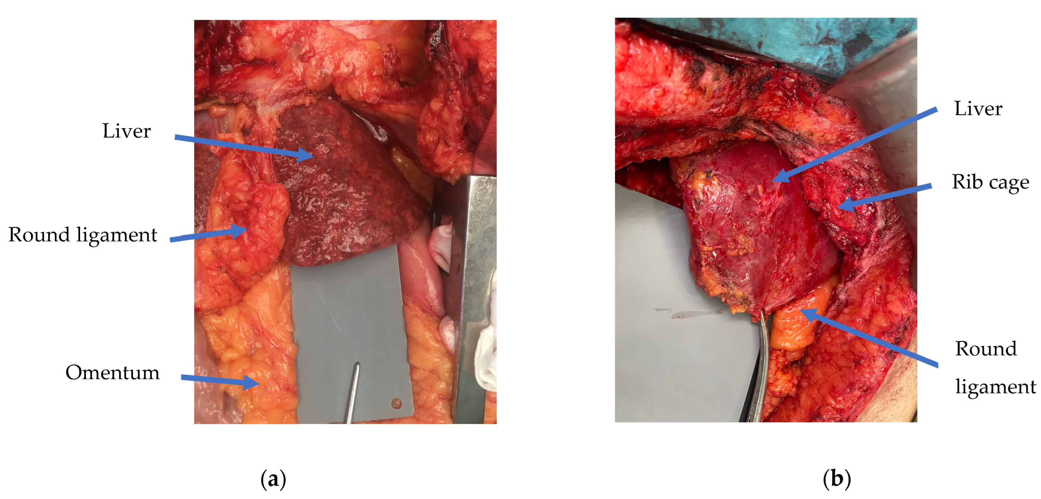 Diagnostics 14 01654 g001