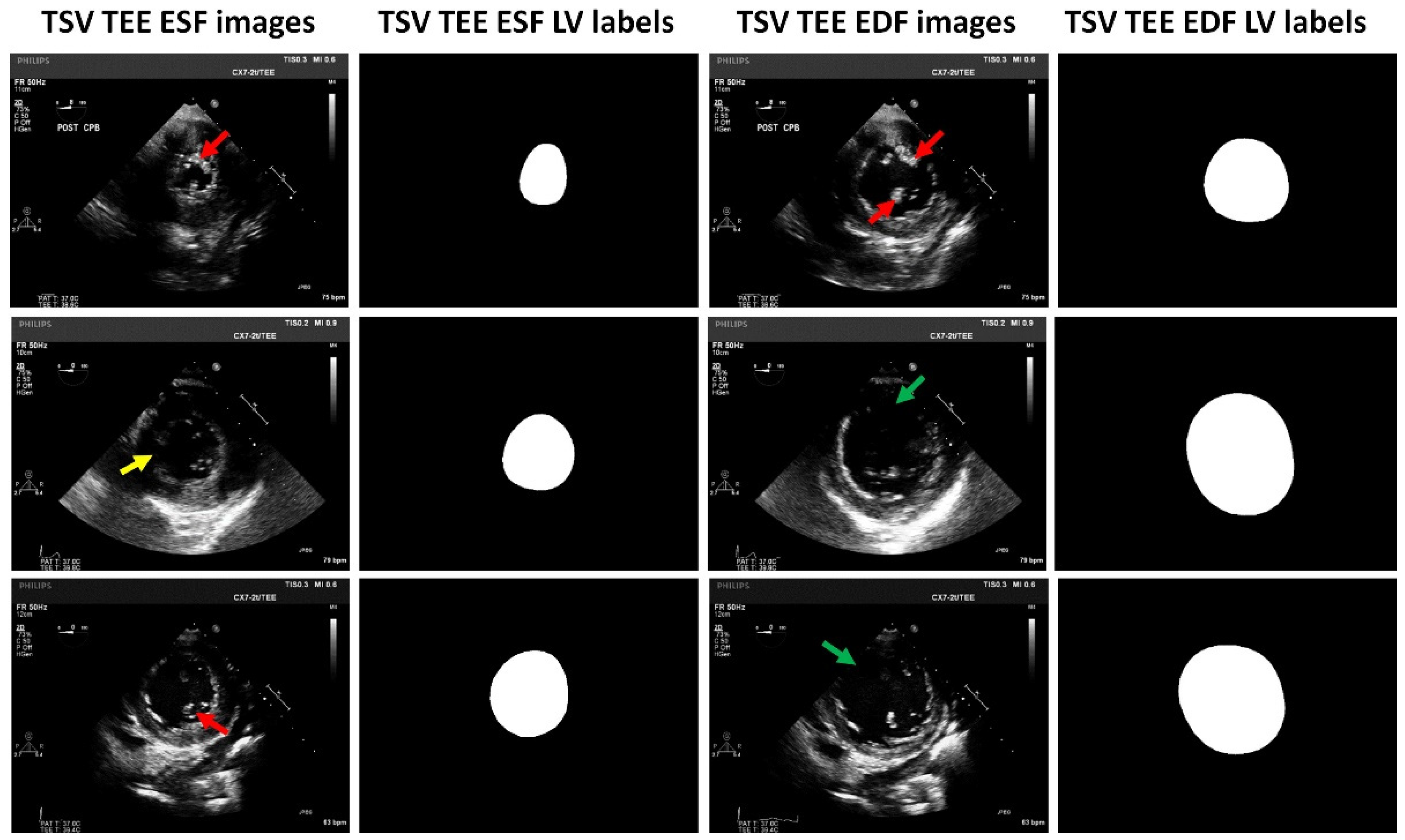 Diagnostics 14 01655 g003