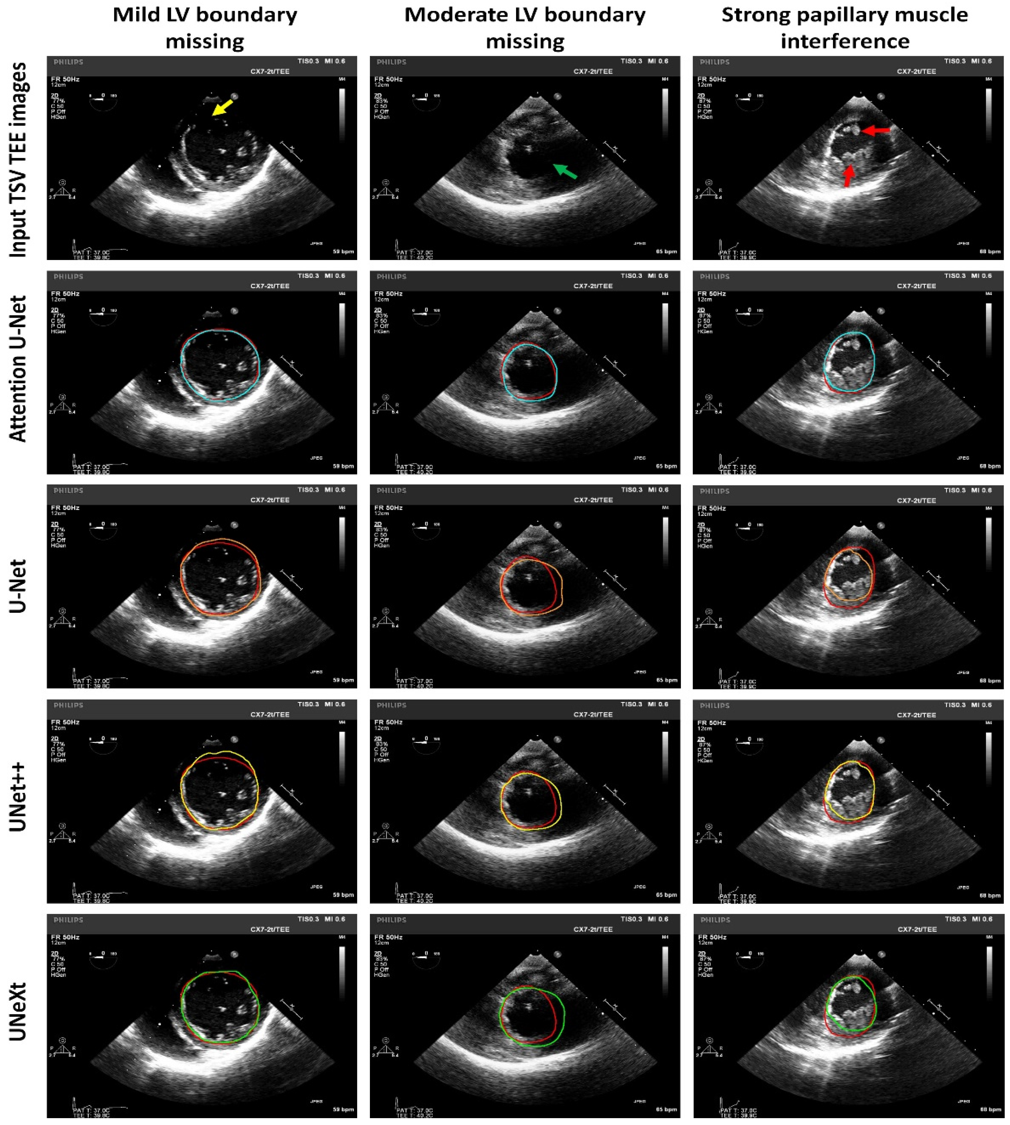 Diagnostics 14 01655 g011