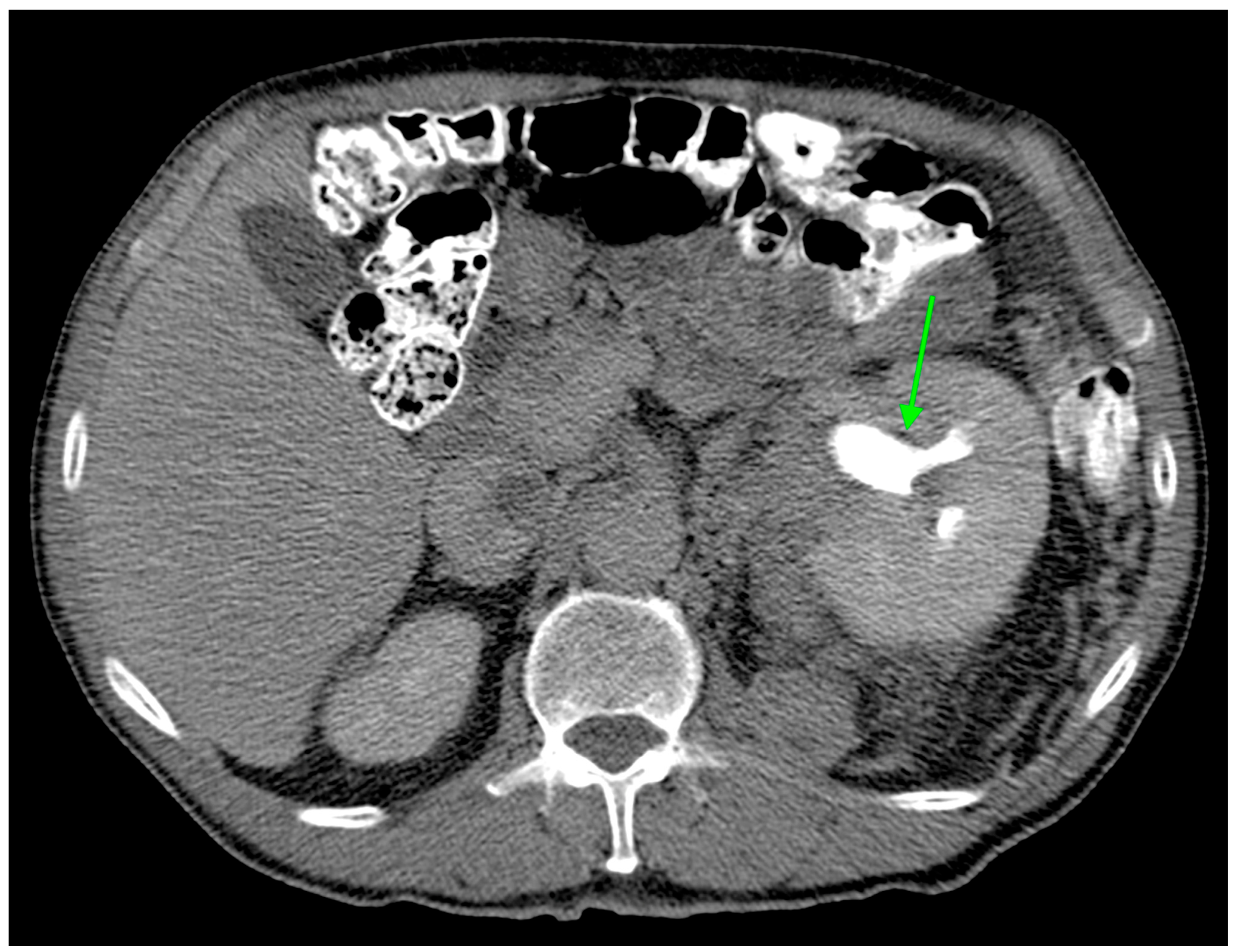 Diagnostics 14 01667 g002