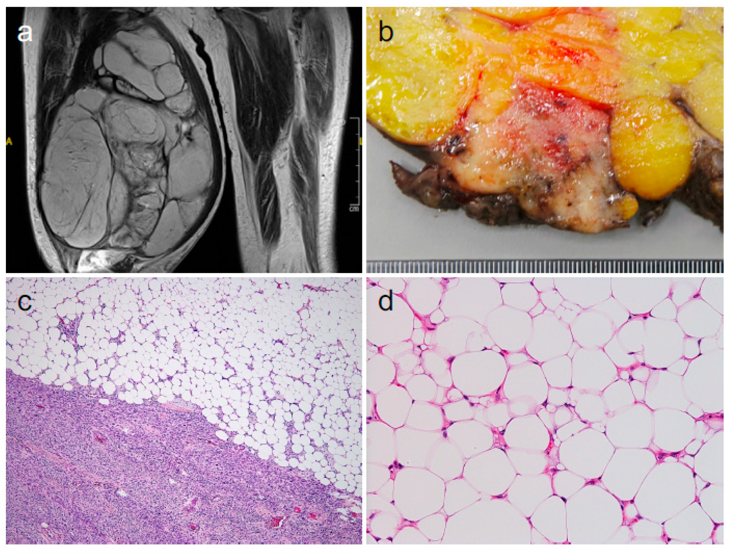 Diagnostics 14 01679 g001