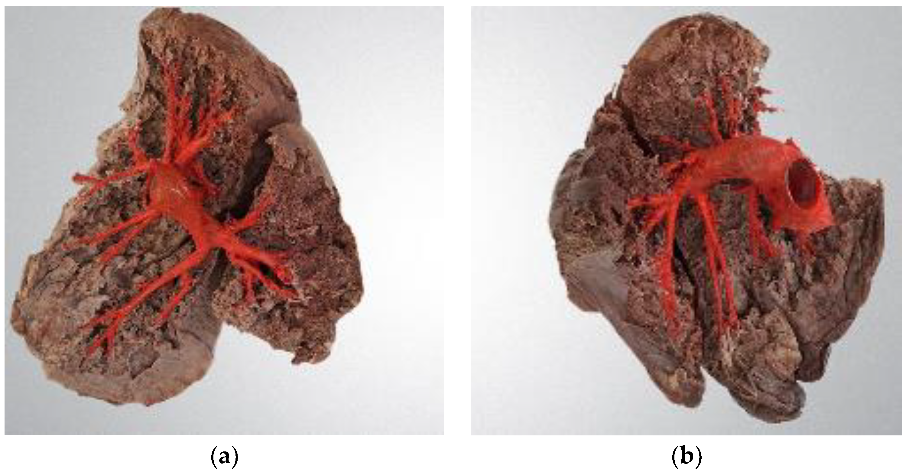 Diagnostics 14 01684 g001
