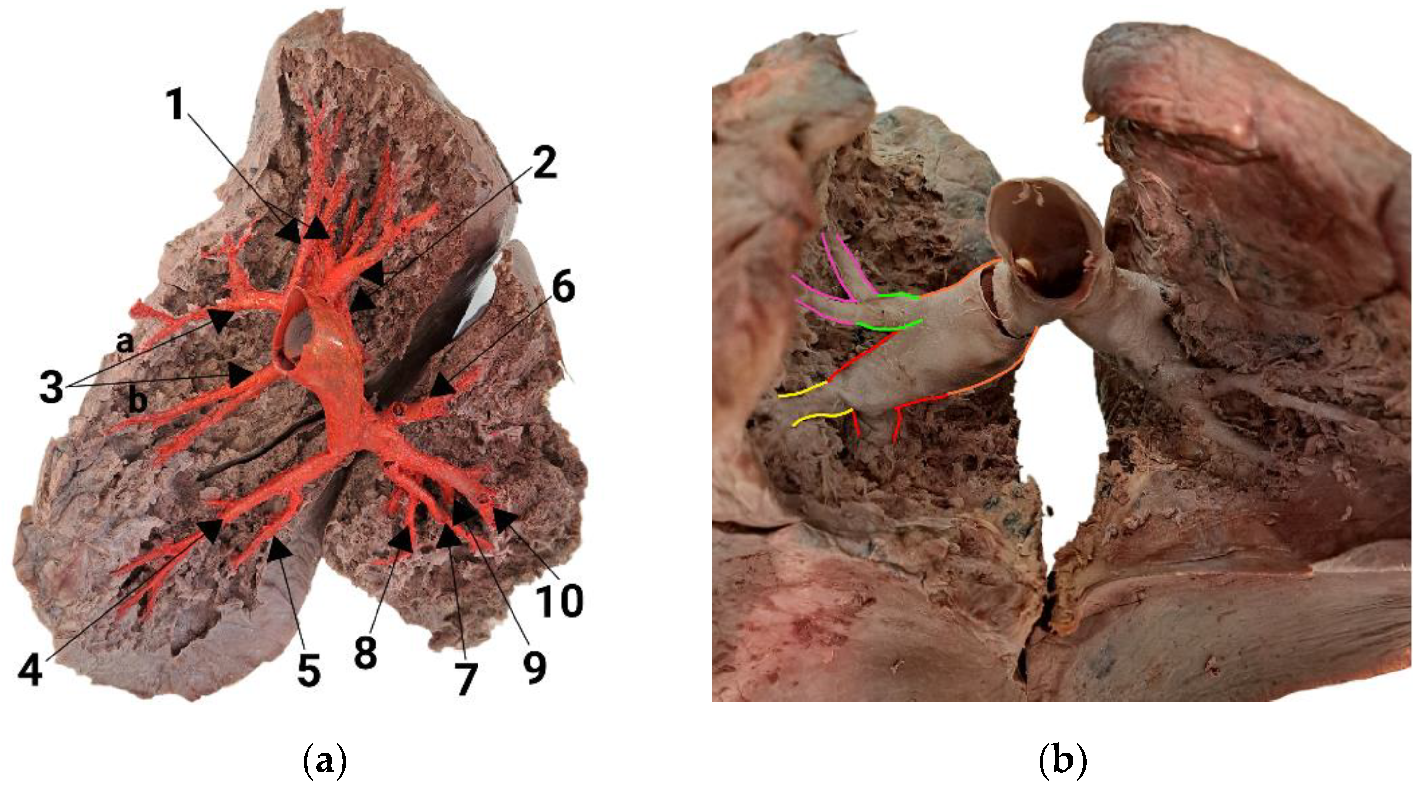 Diagnostics 14 01684 g002