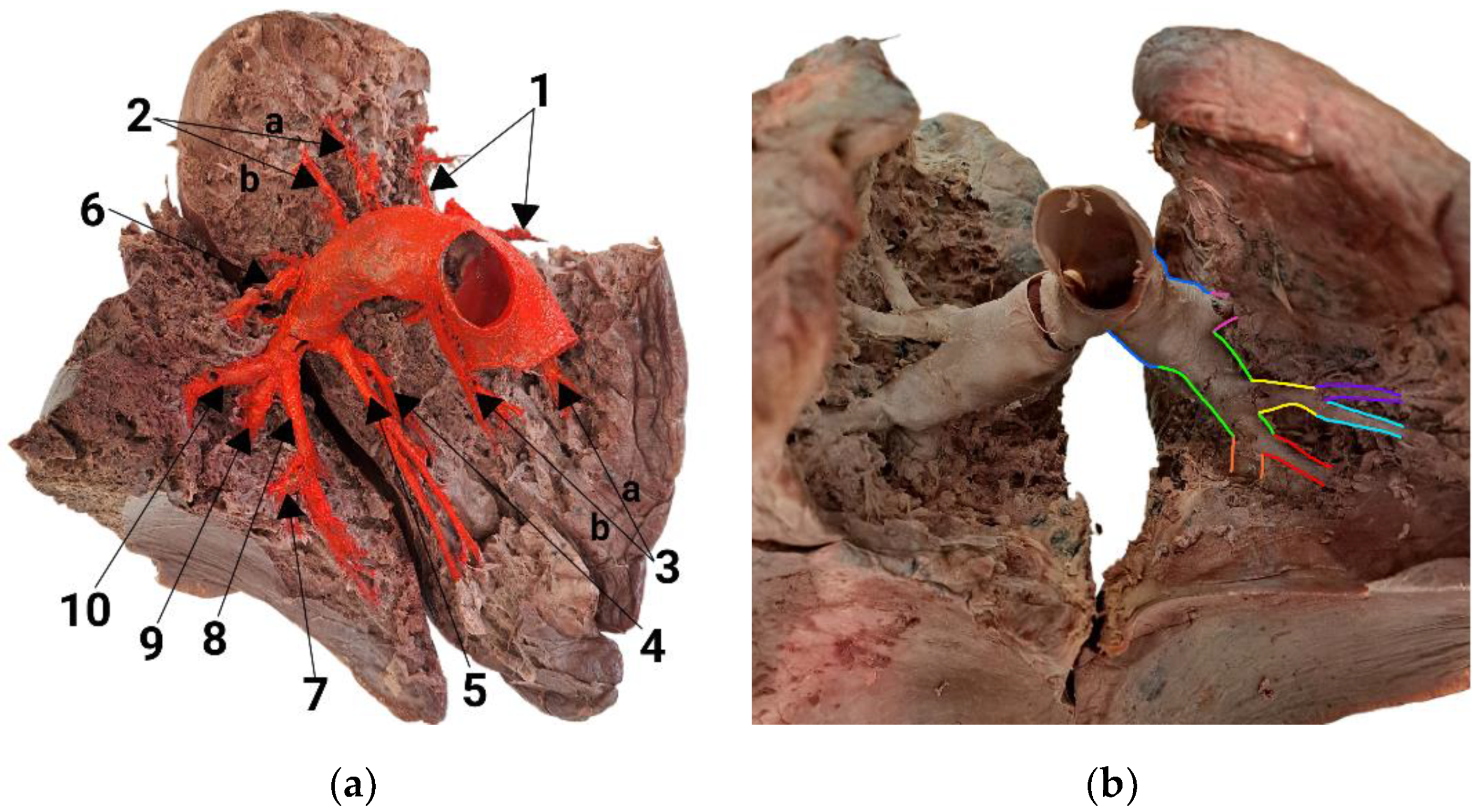 Diagnostics 14 01684 g003