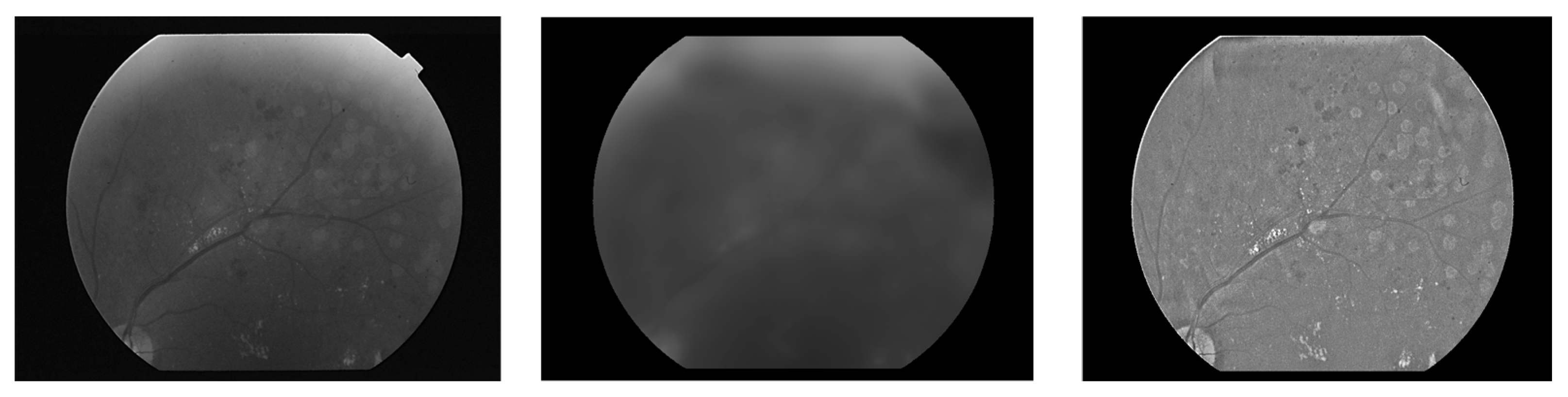 Diagnostics 14 01688 g003