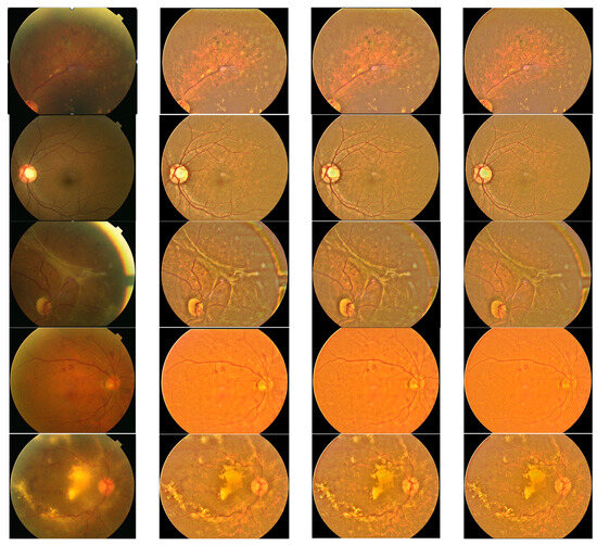 Enhancing Retina Images by Lowpass Filtering Using Binomial Filter