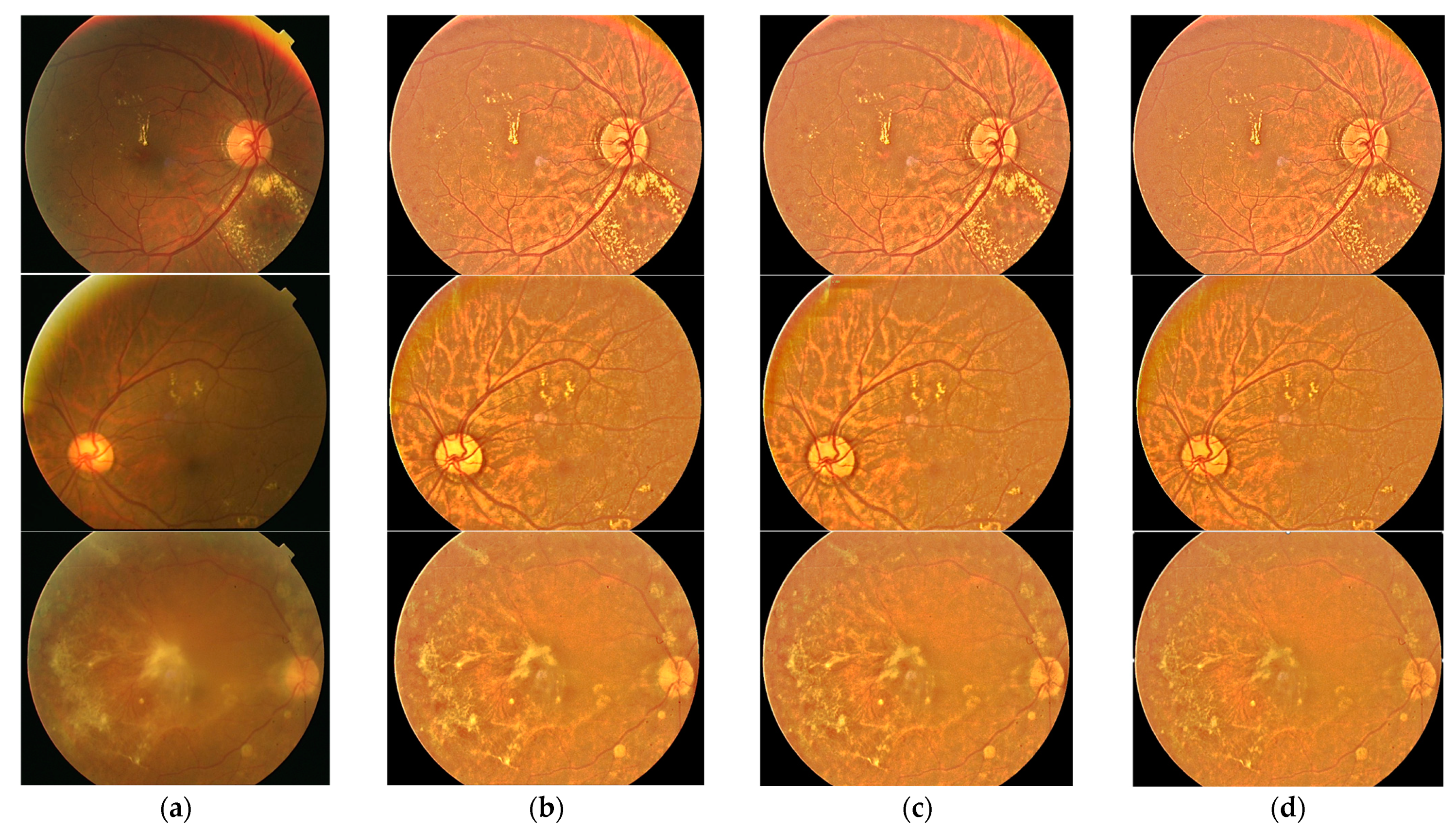 Diagnostics 14 01688 g005b