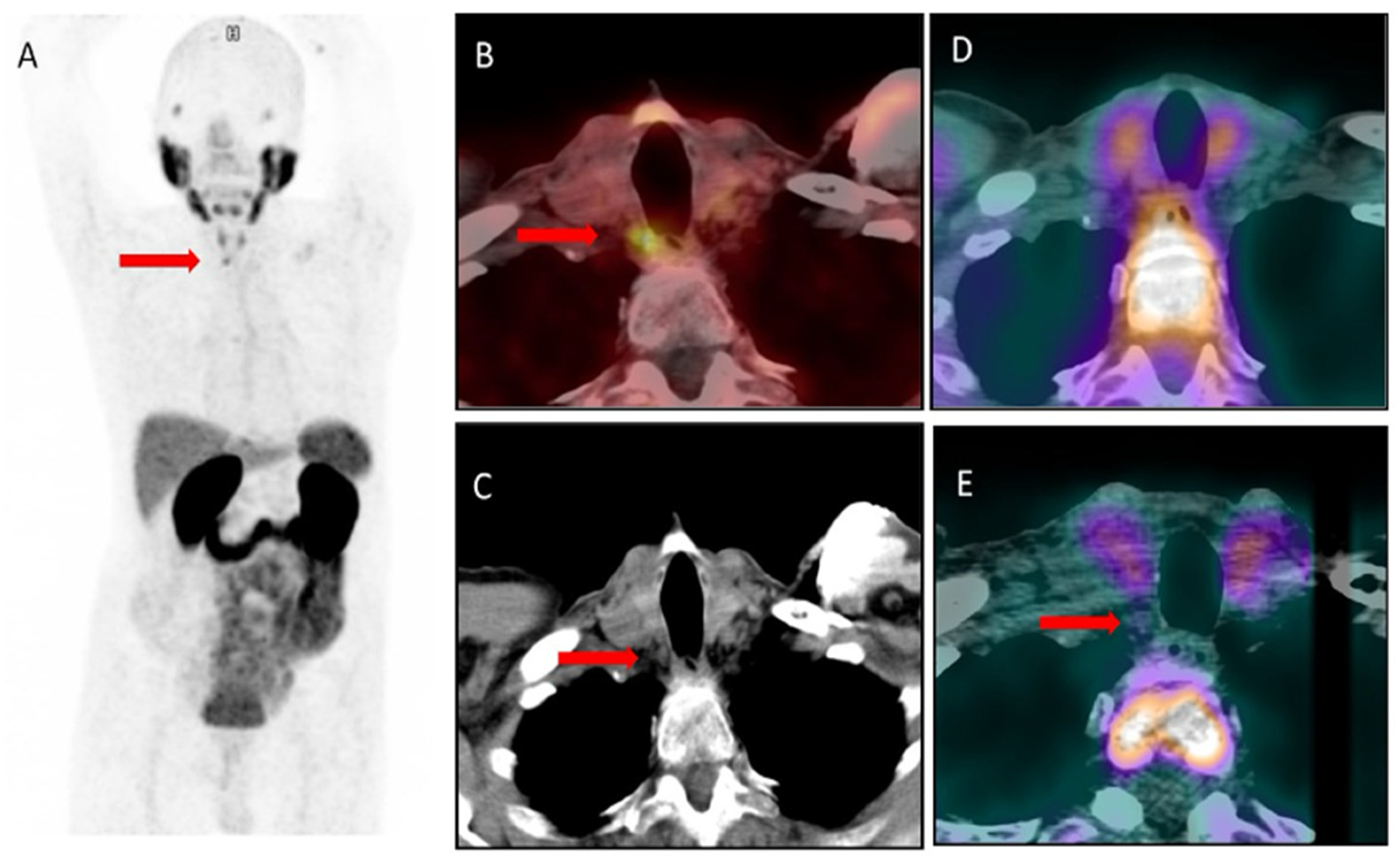 Diagnostics 14 01690 g001