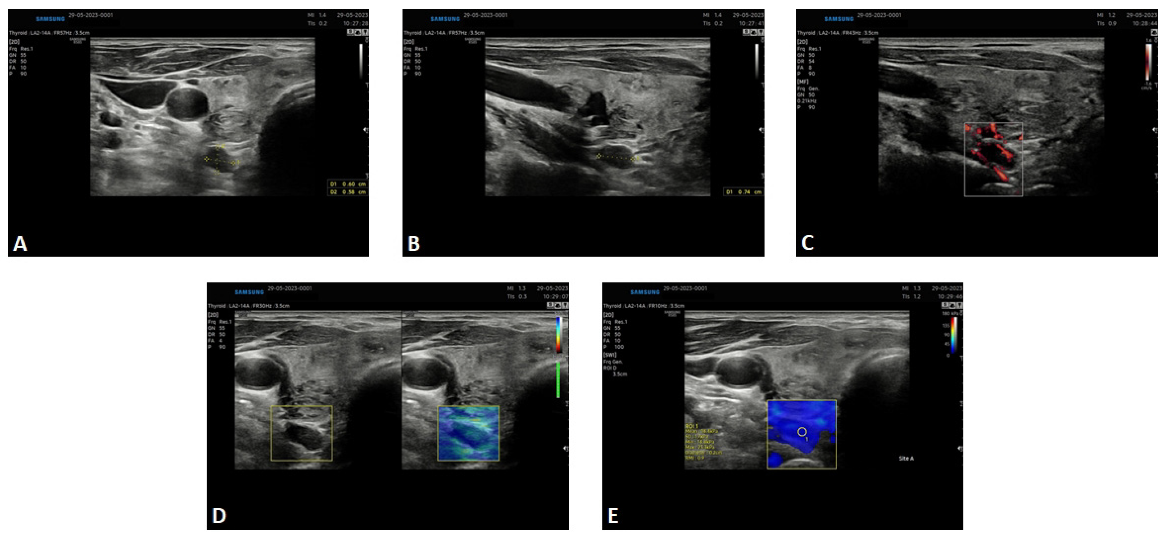 Diagnostics 14 01690 g002
