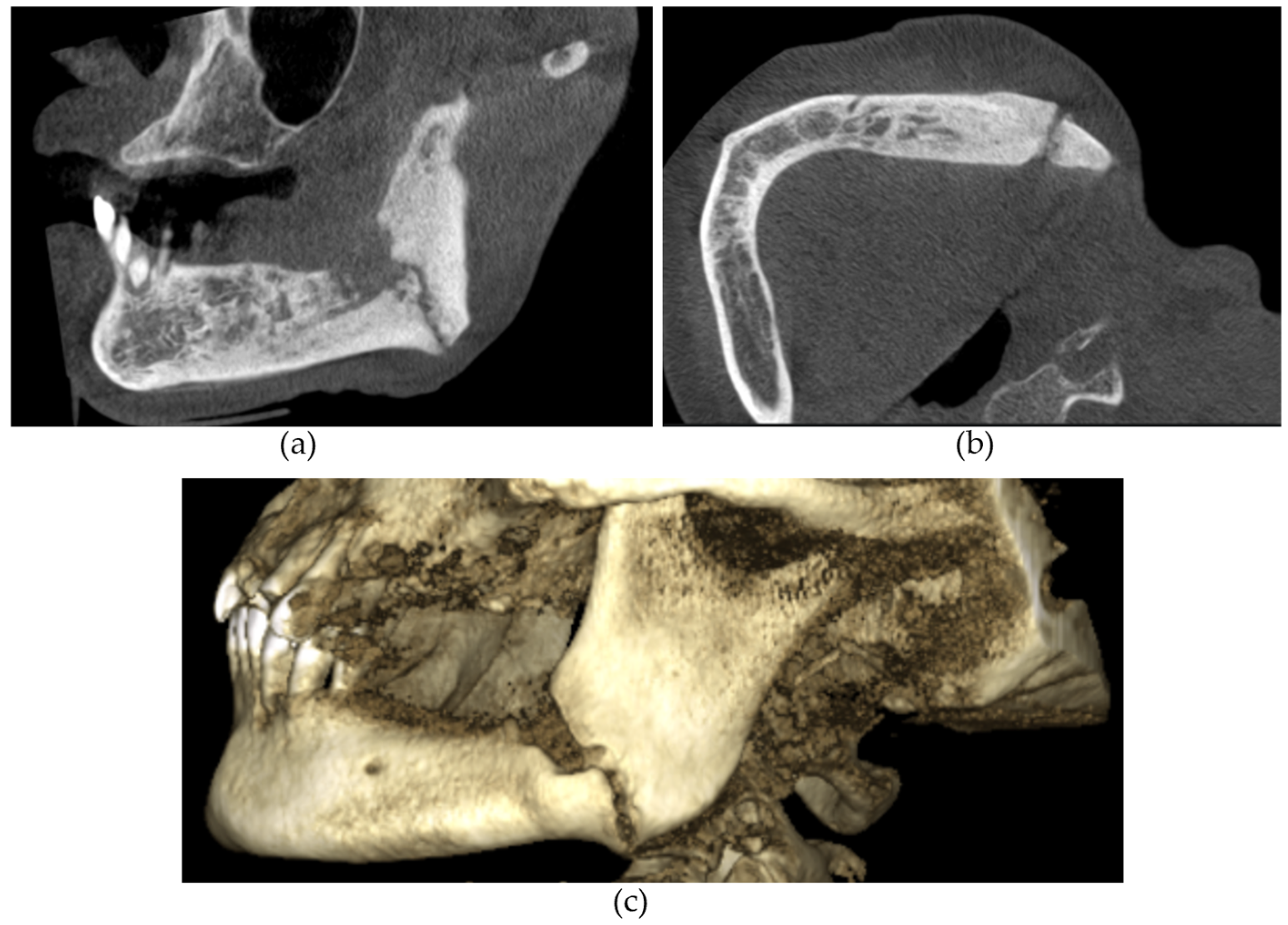 Diagnostics 14 01700 g003