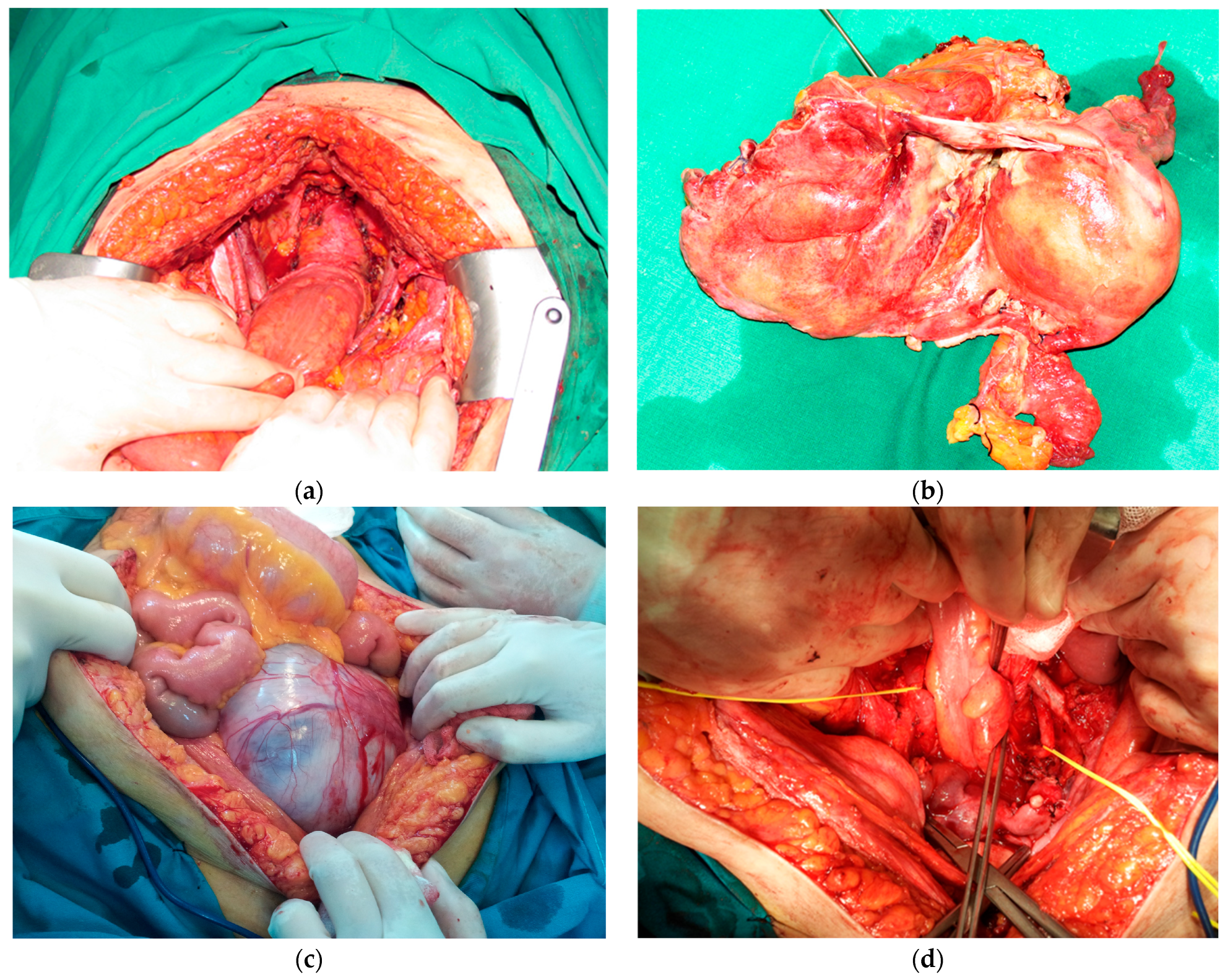 Diagnostics 14 01707 g001