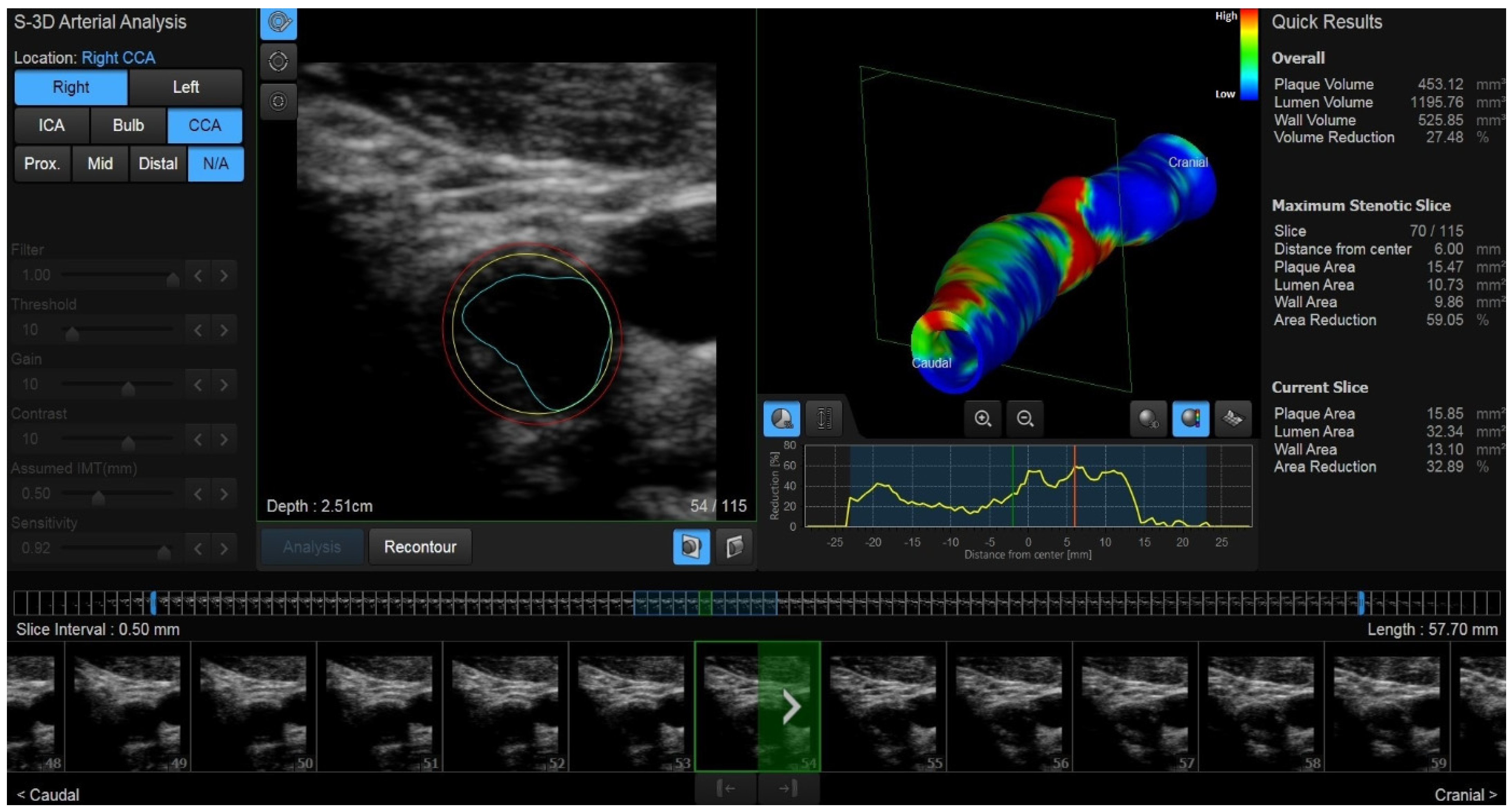 Diagnostics 14 01708 g001