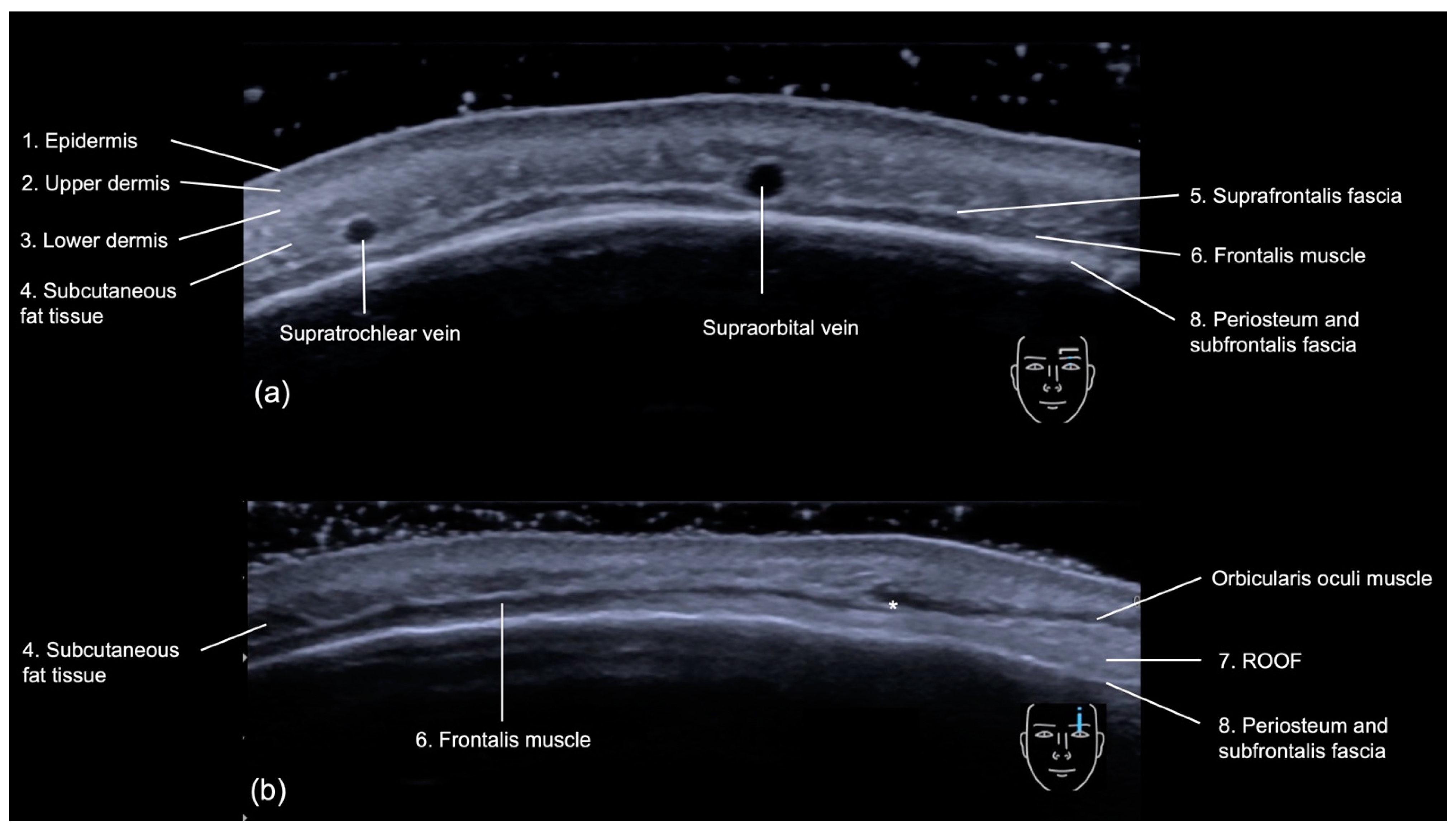 Diagnostics 14 01718 g005
