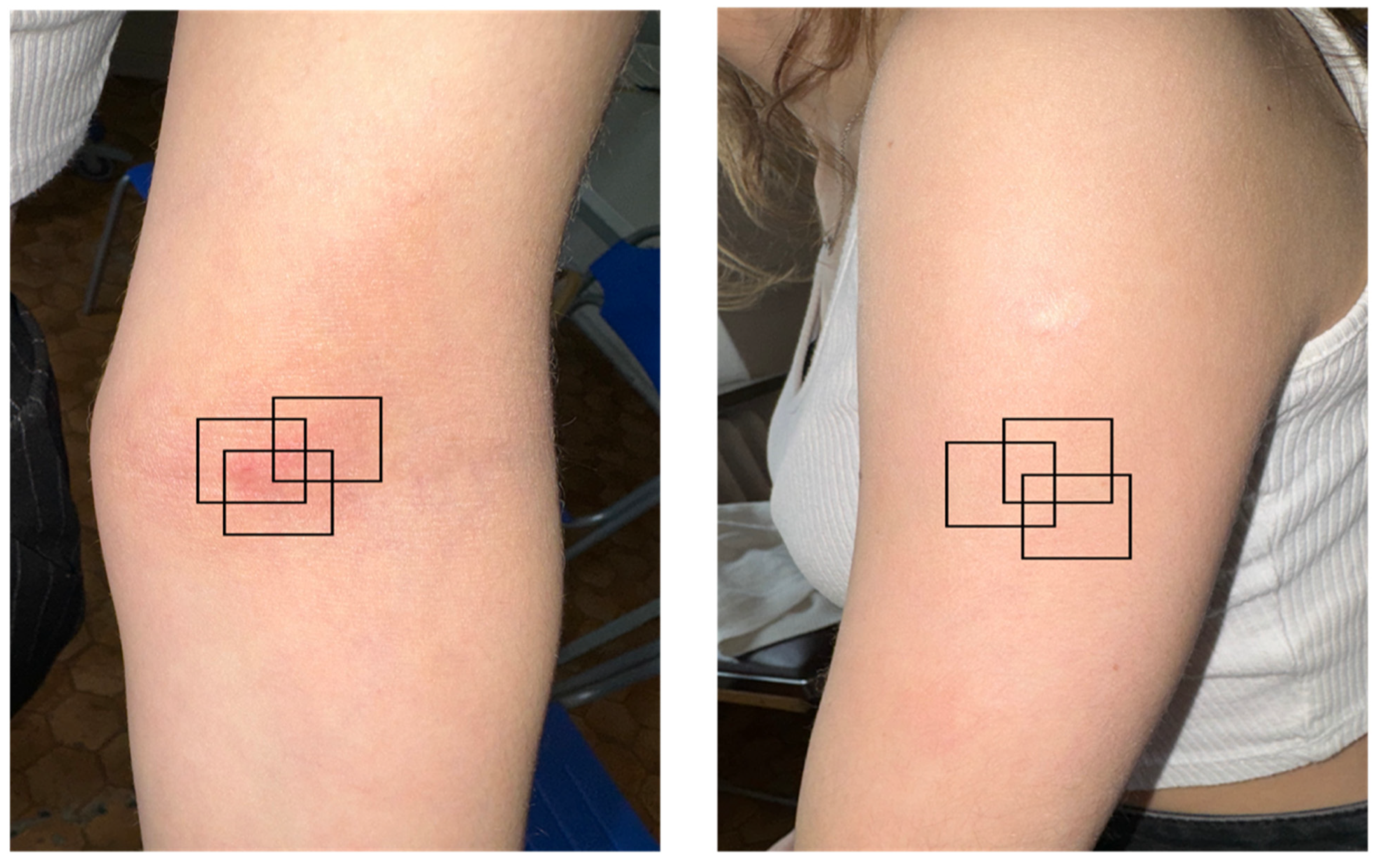 Diagnostics 14 01724 g001