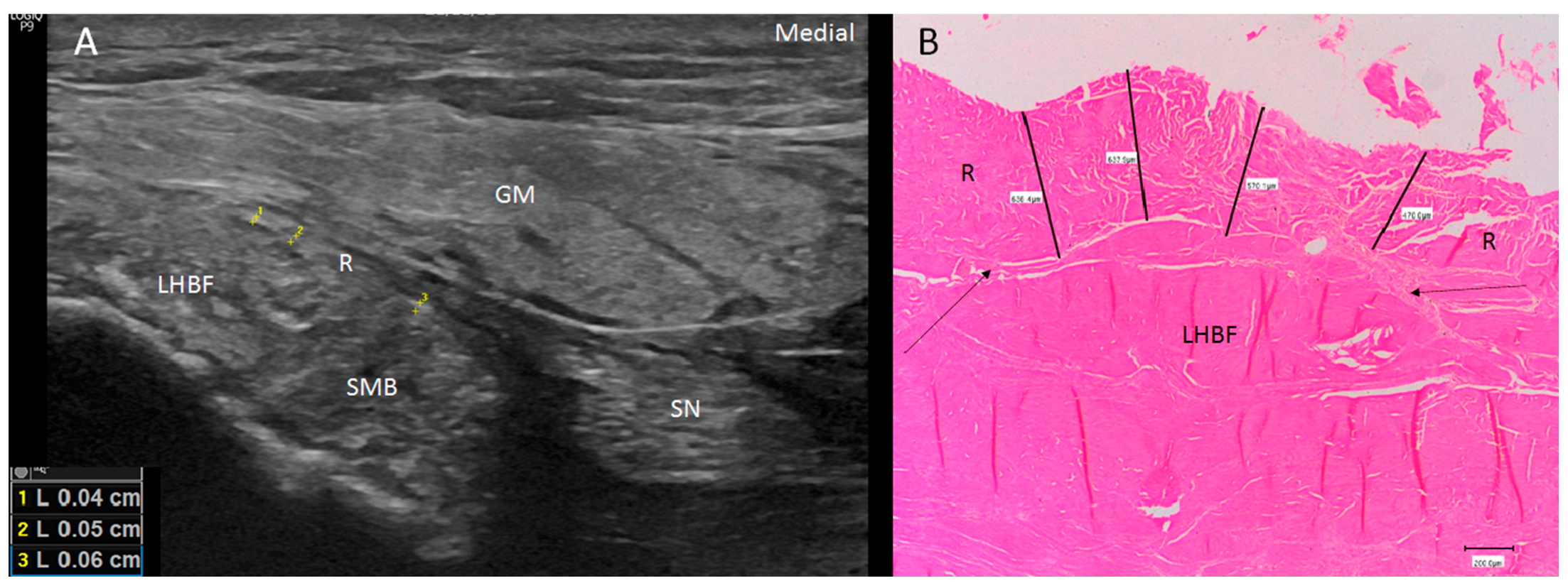 Diagnostics 14 01725 g003