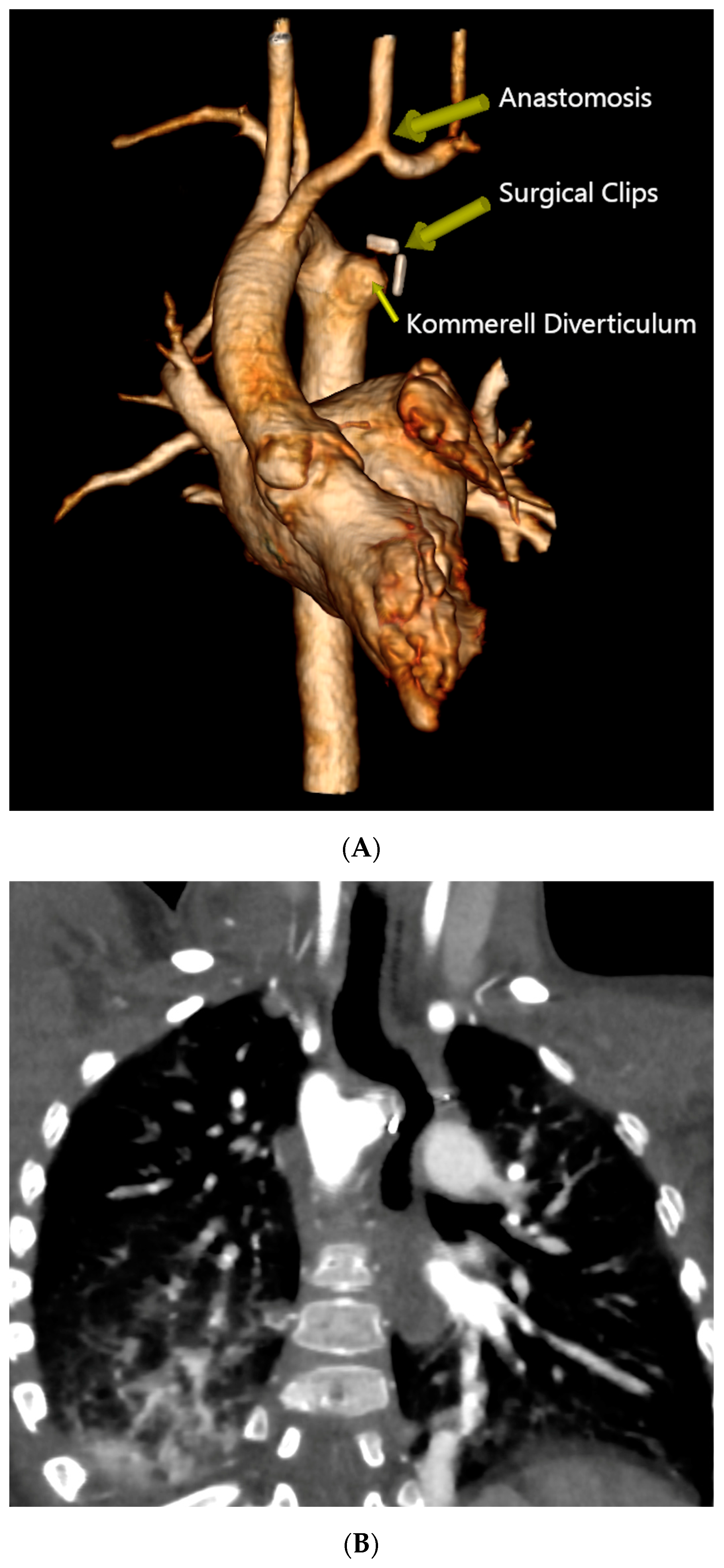 Diagnostics 14 01736 g003a