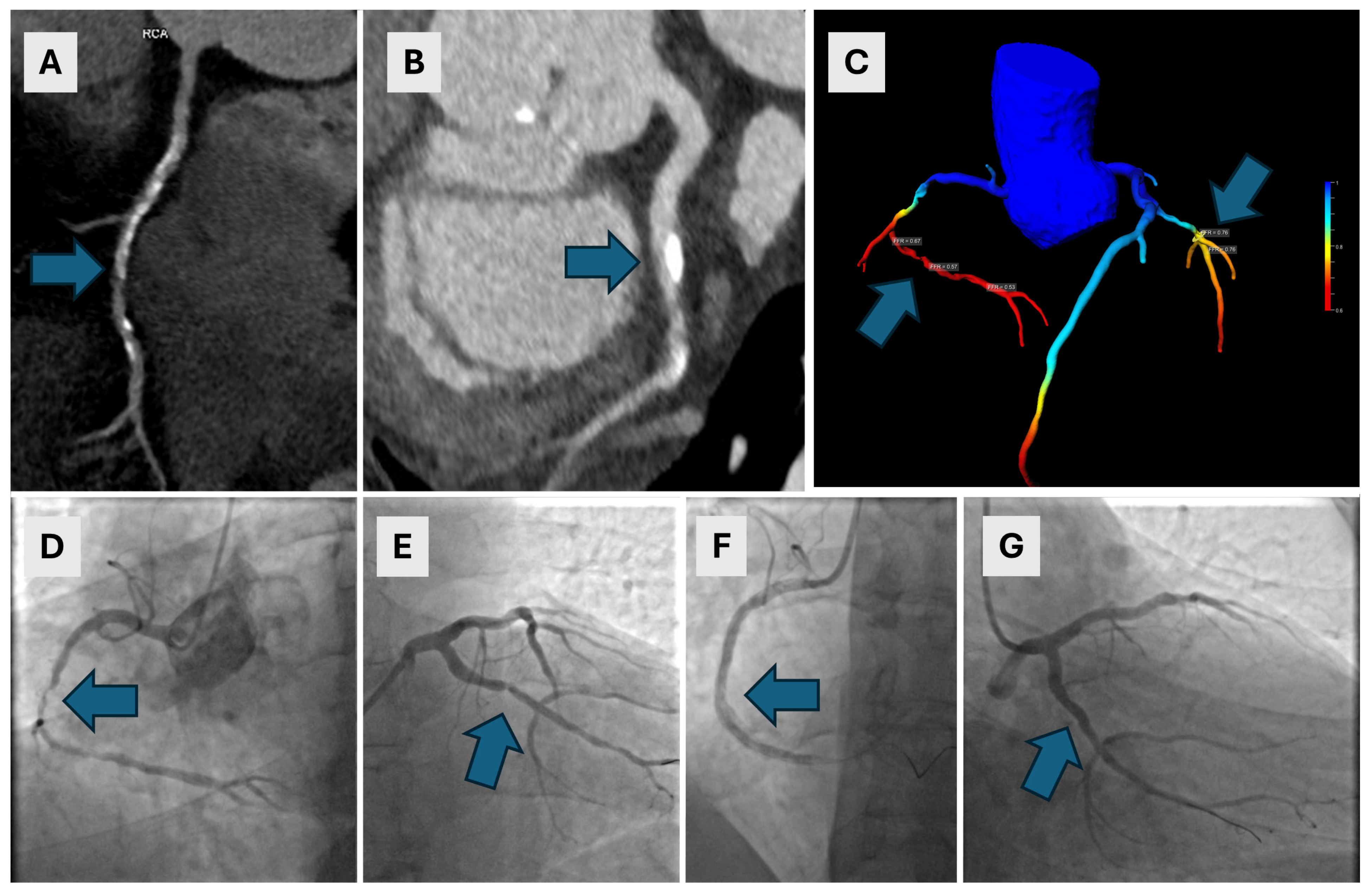 Diagnostics 14 01738 g004