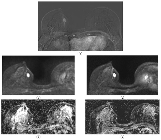 Optimizing Image Quality with High-Resolution, Deep-Learning-Based