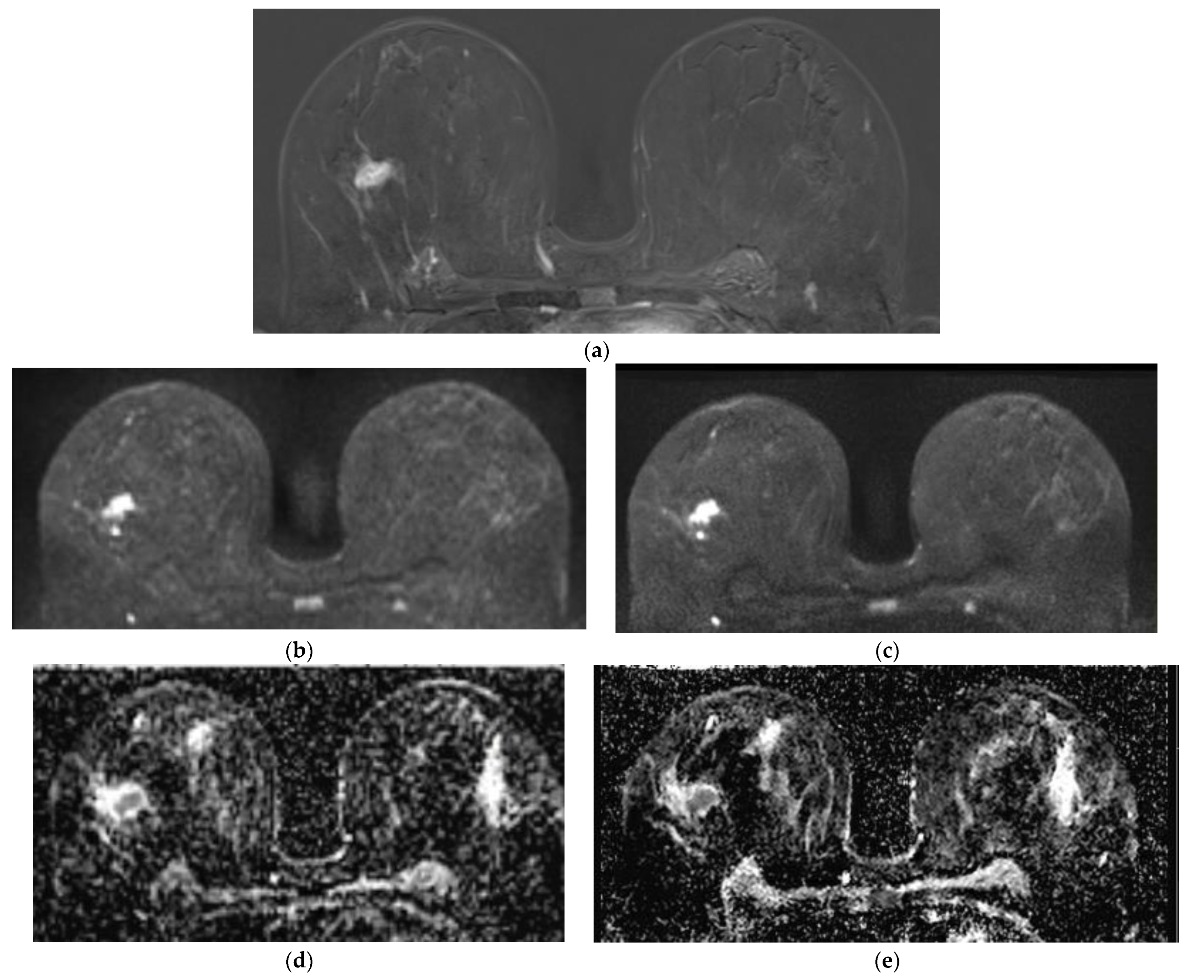 Diagnostics 14 01742 g003