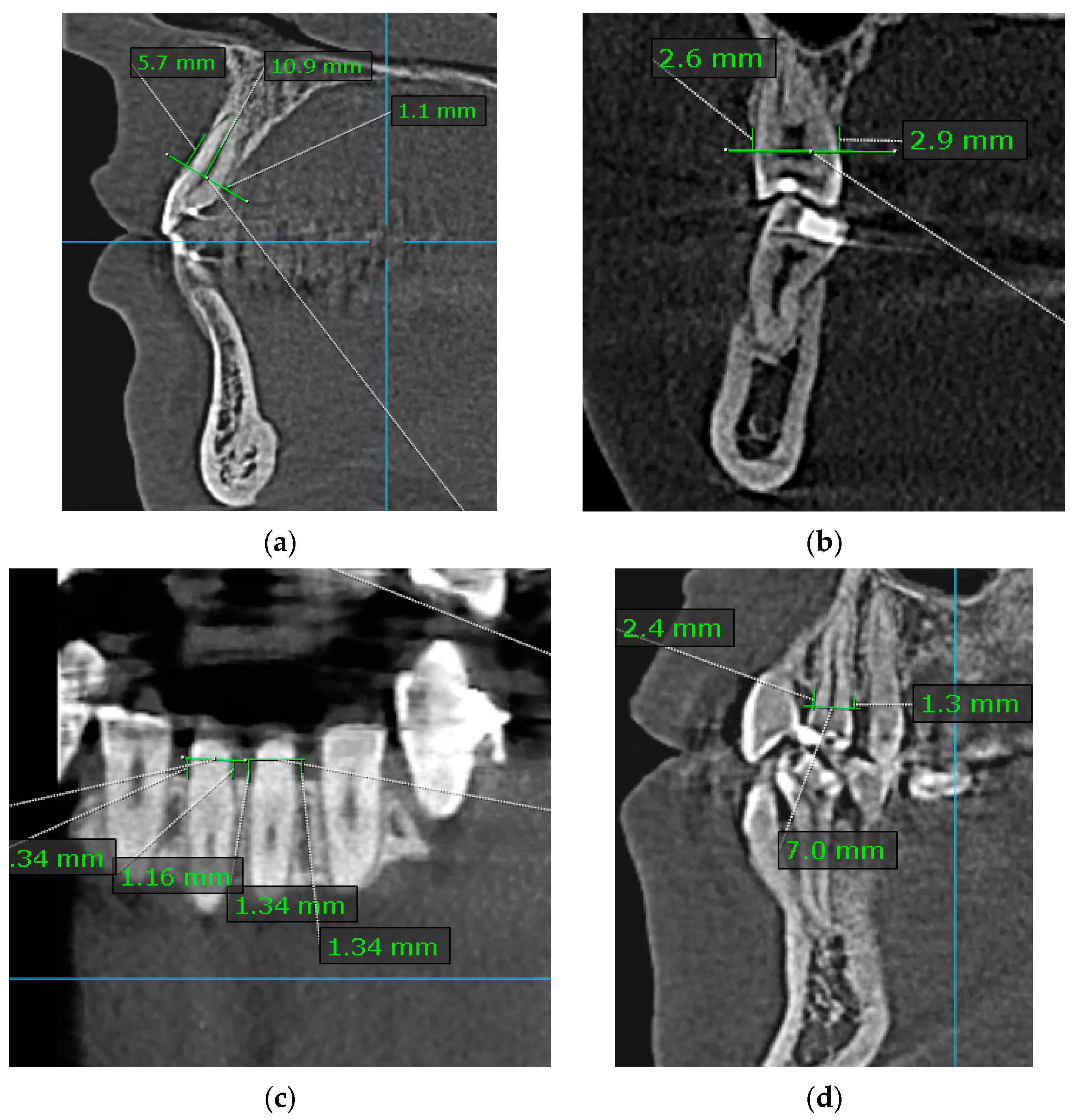 Diagnostics 14 01757 g001