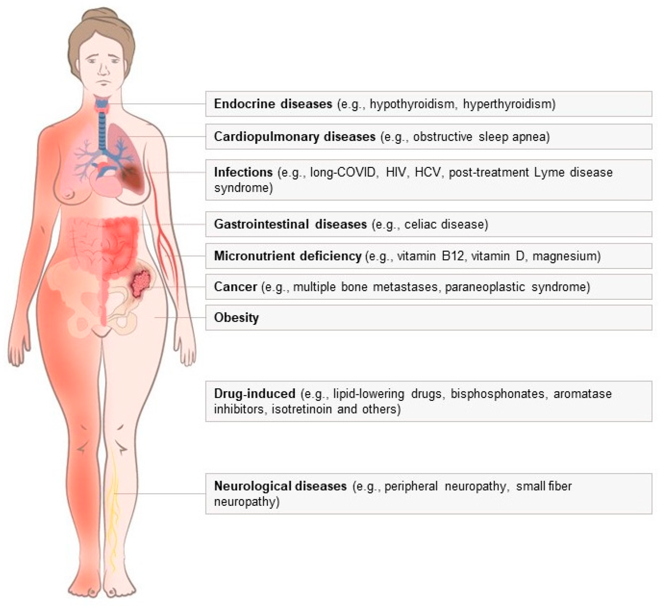 Common Non-Rheumatic Medical Conditions Mimicking Fibromyalgia: A 