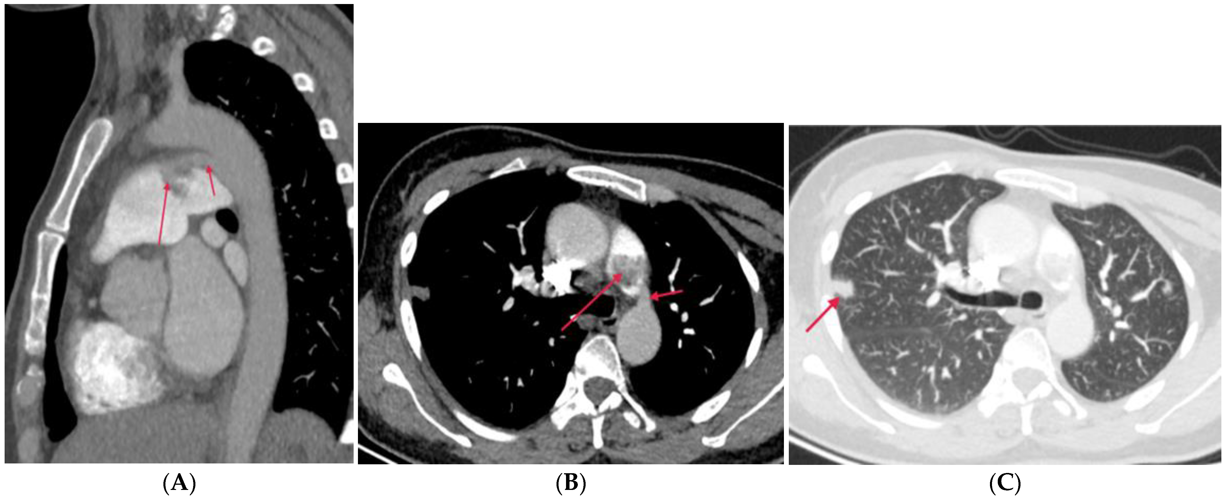 Diagnostics 14 01762 g009
