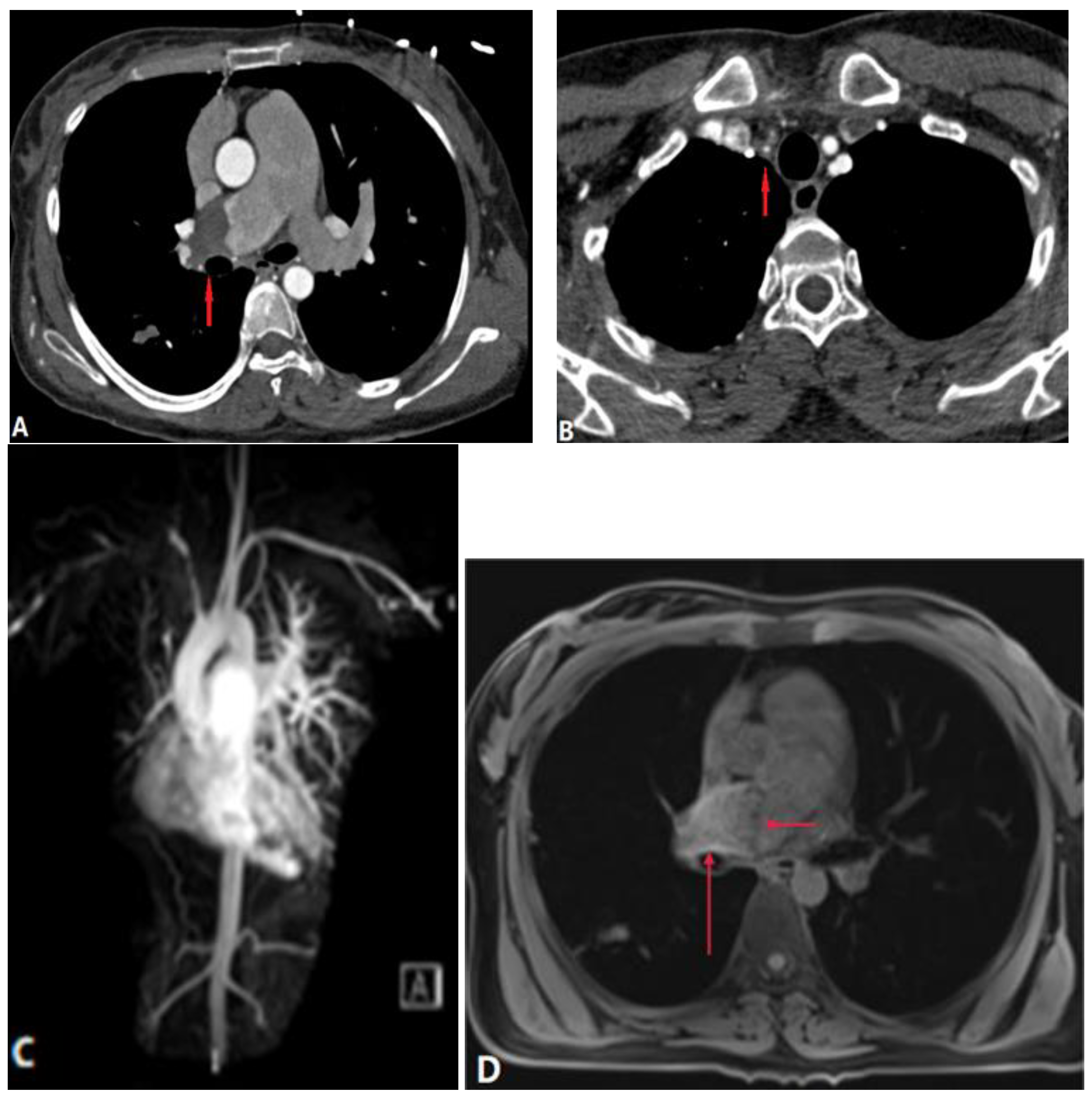 Diagnostics 14 01762 g013